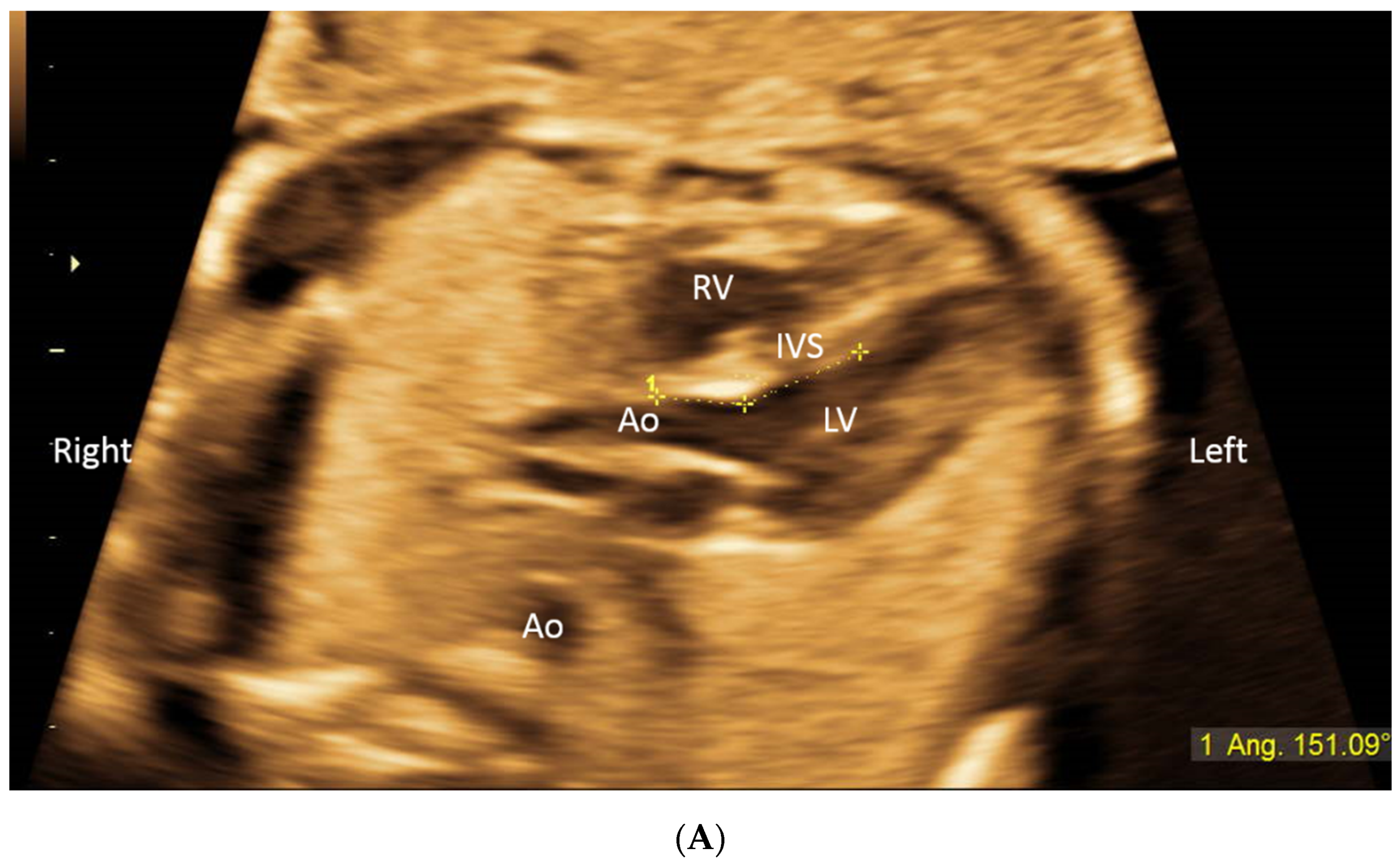 Diagnostics 11 01185 g001a