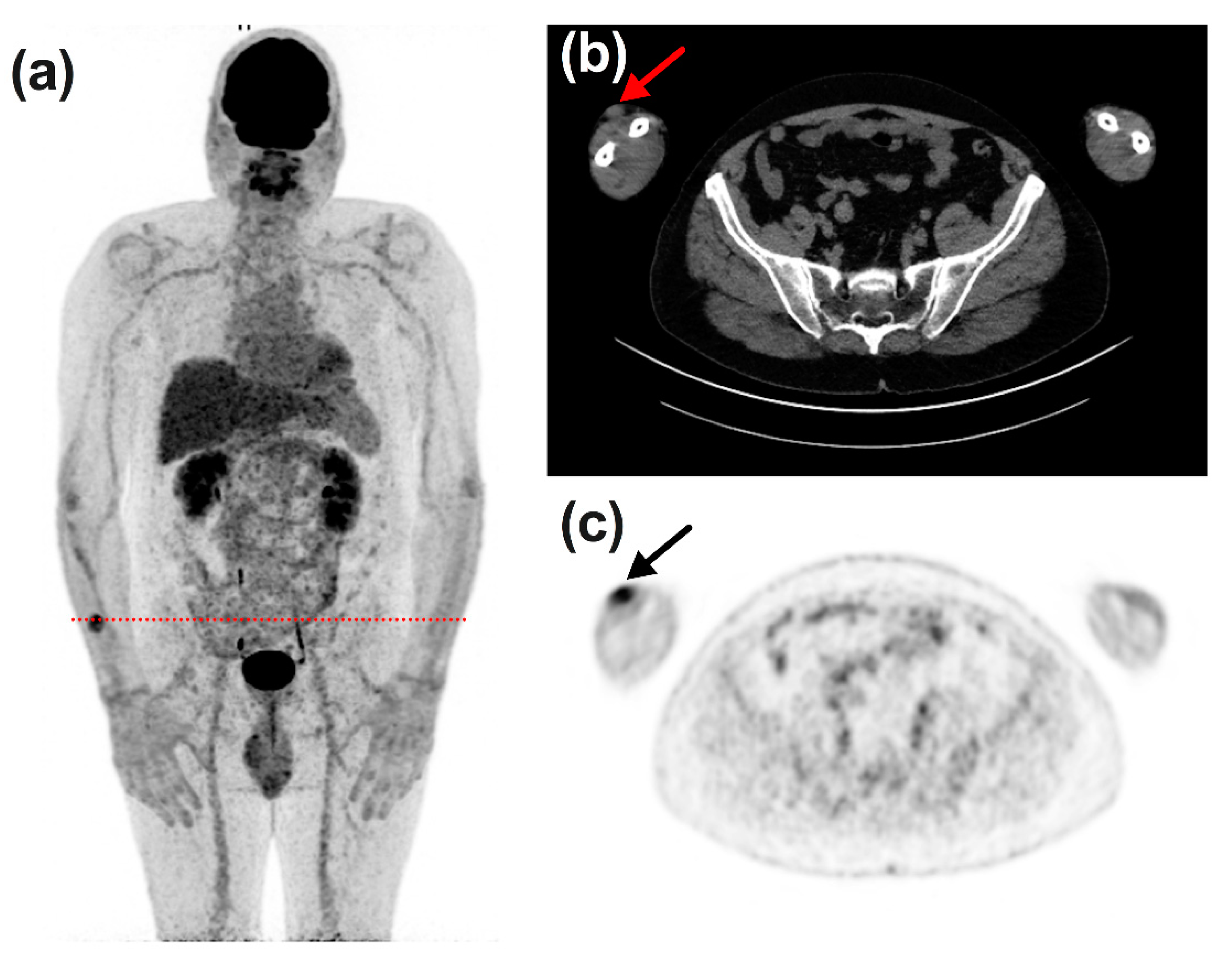 Diagnostics 11 01198 g006 550