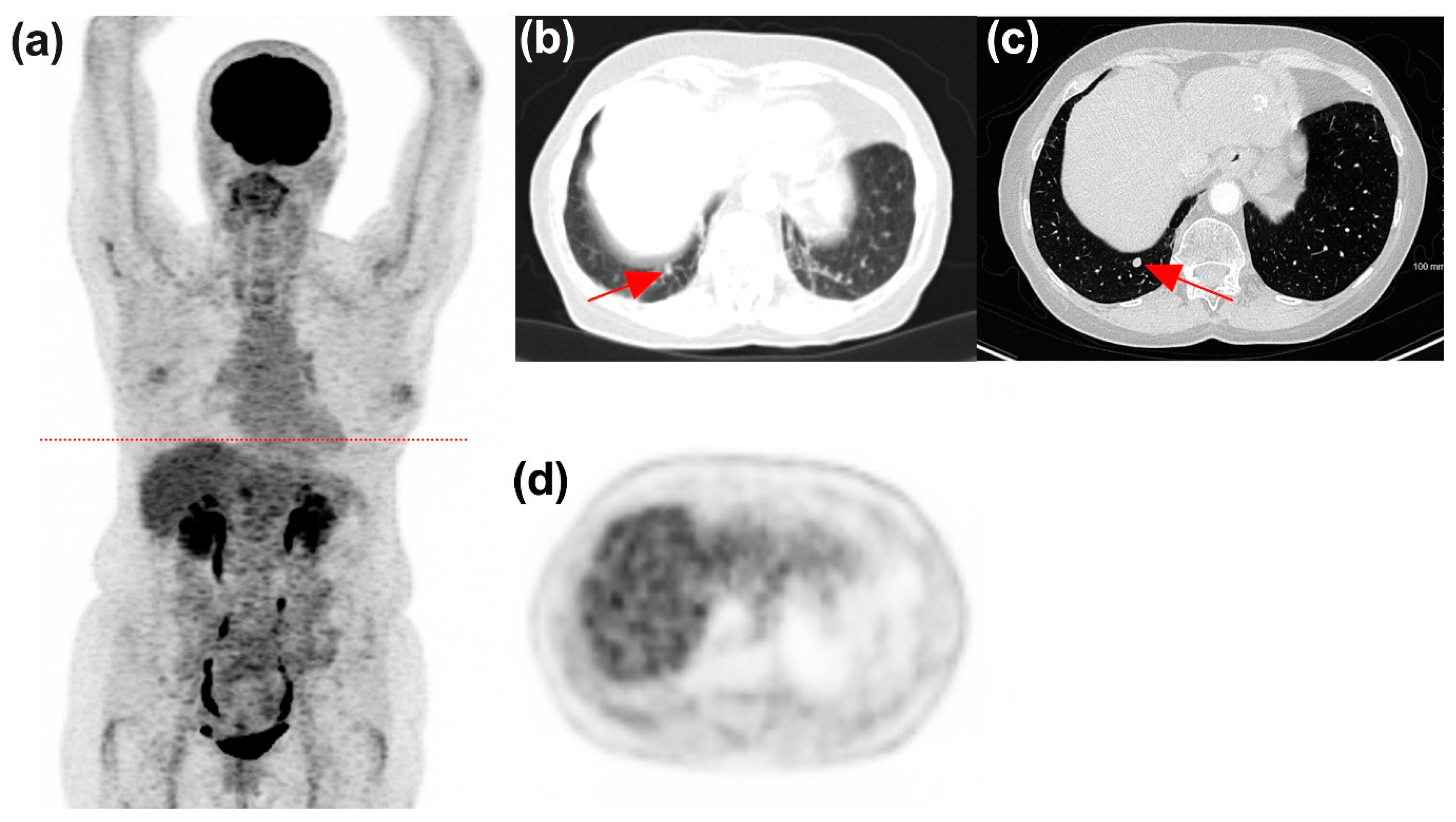 Diagnostics 11 01198 g007 550