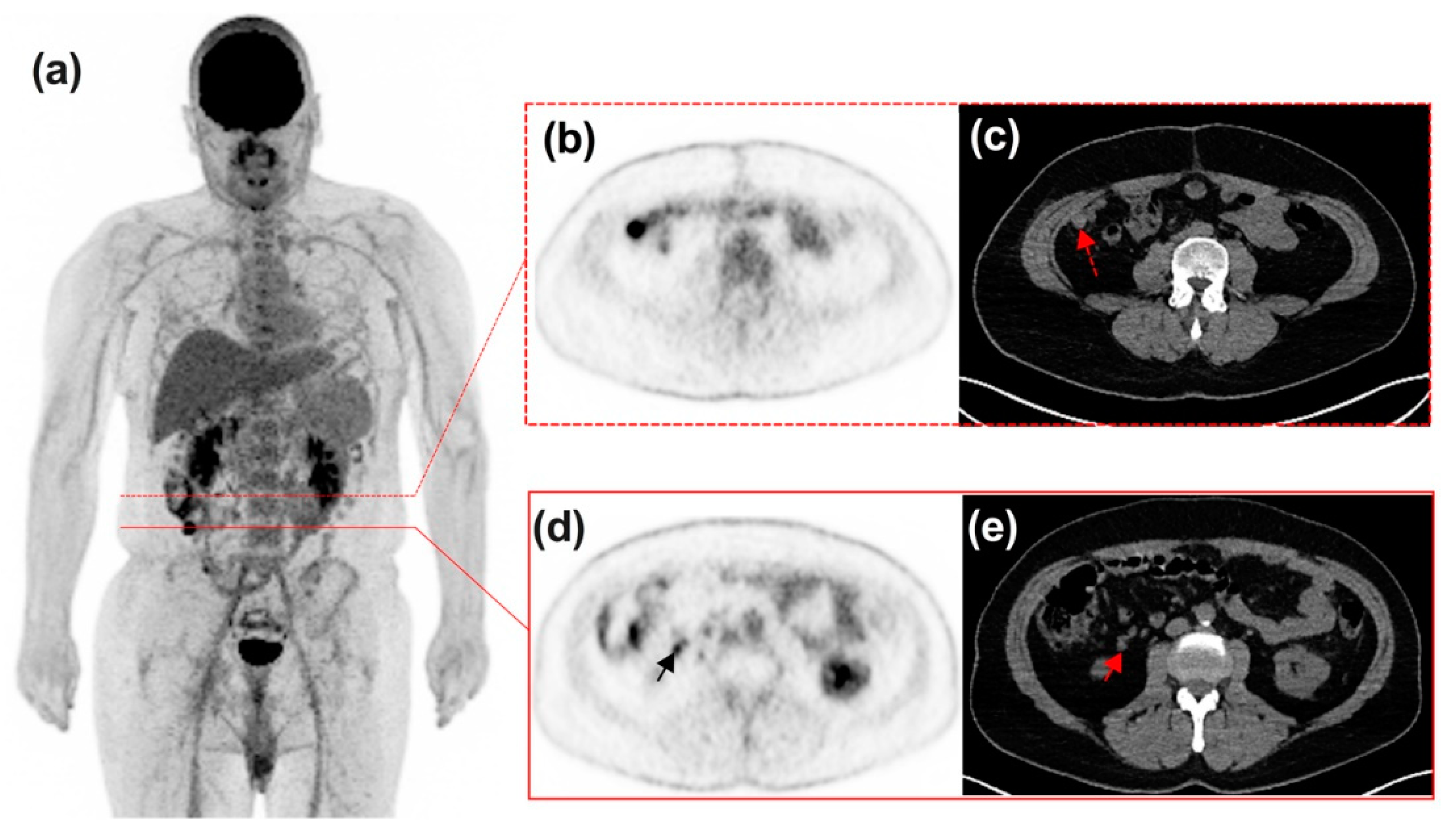 Diagnostics 11 01198 g008 550