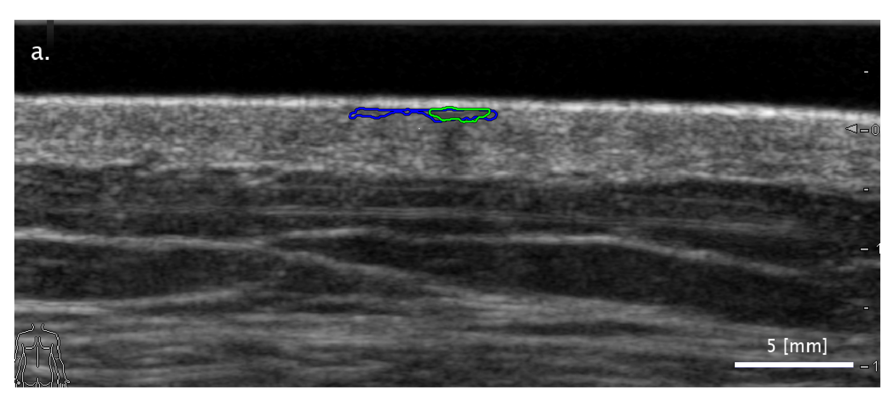 Diagnostics 11 01207 g004a