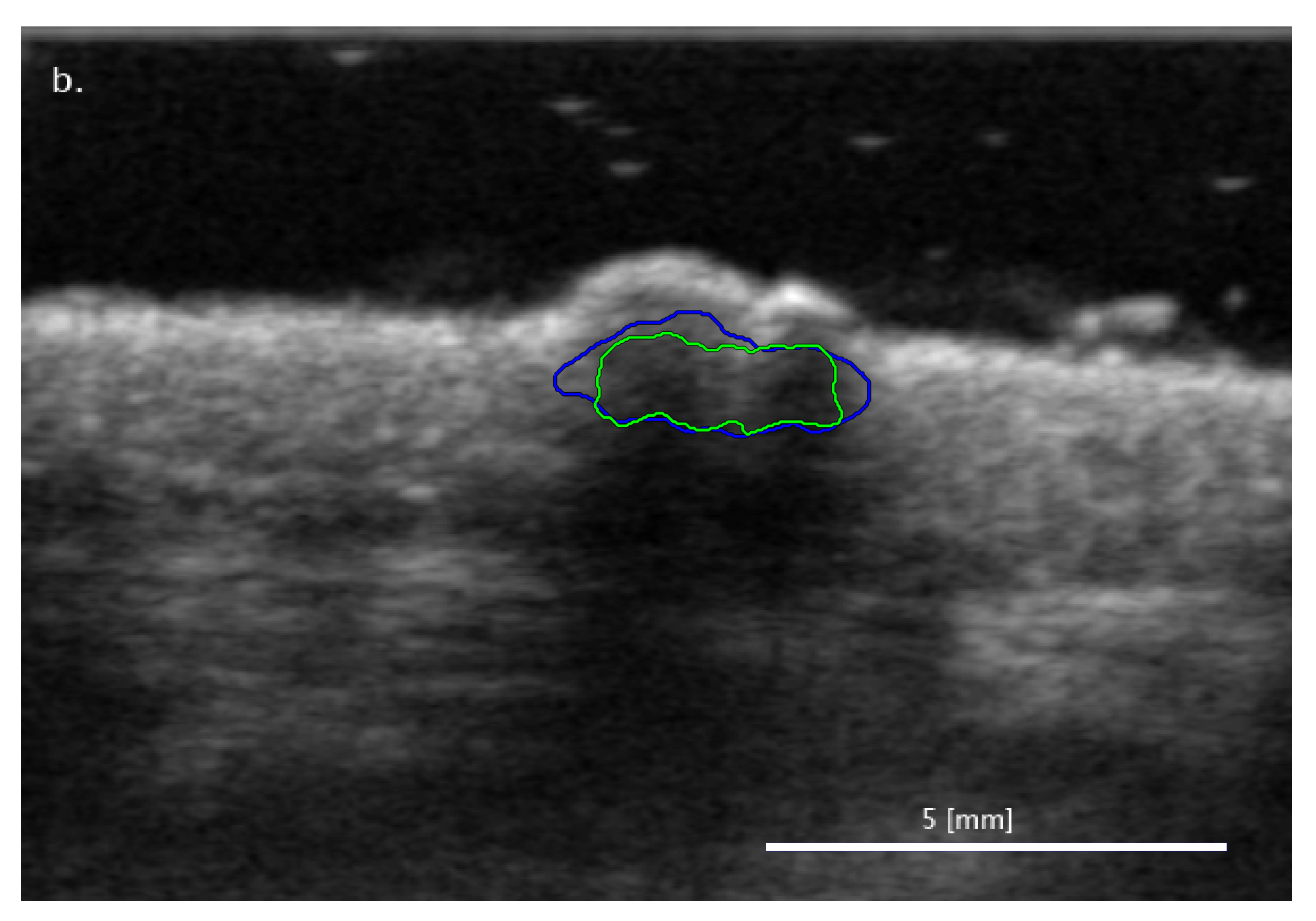 Diagnostics 11 01207 g004b