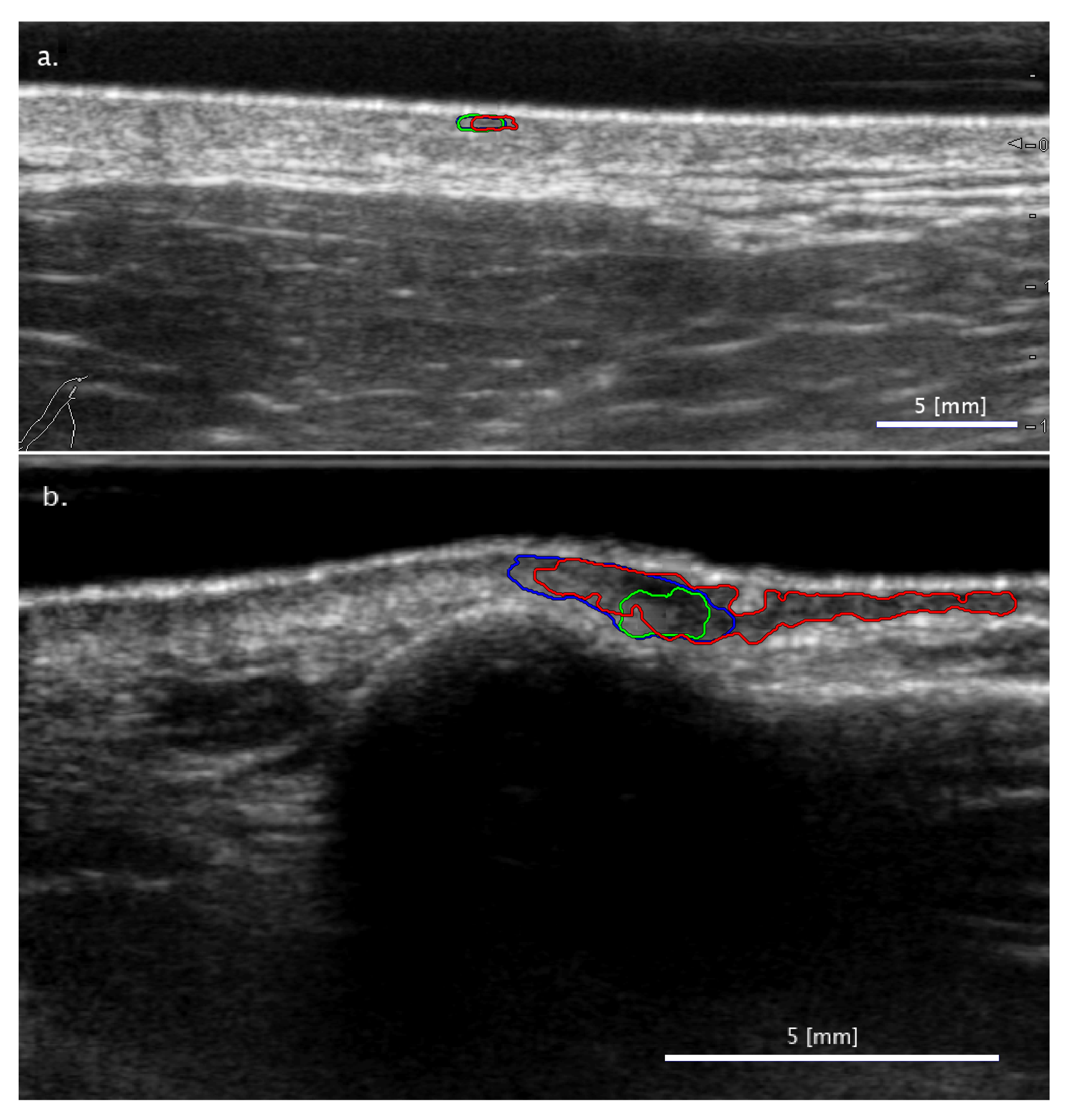 Diagnostics 11 01207 g005a