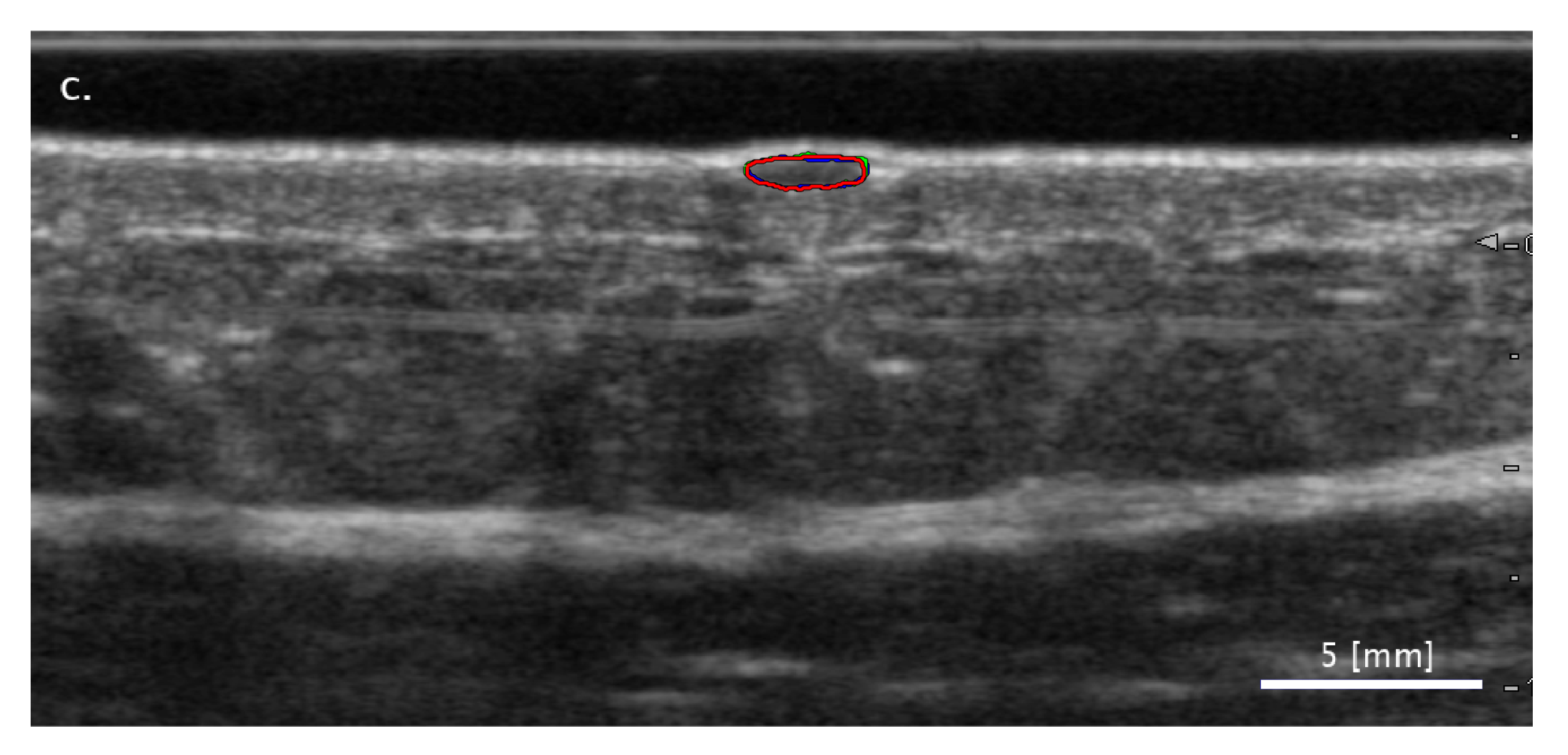 Diagnostics 11 01207 g005b