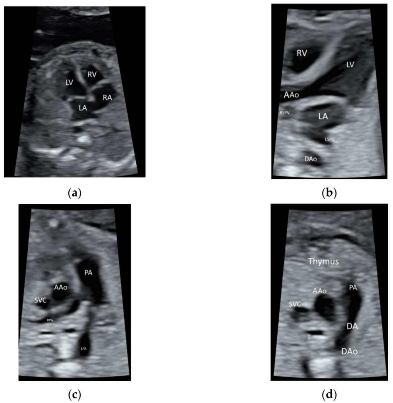 Quantitative Approach to Quality Review of Prenatal