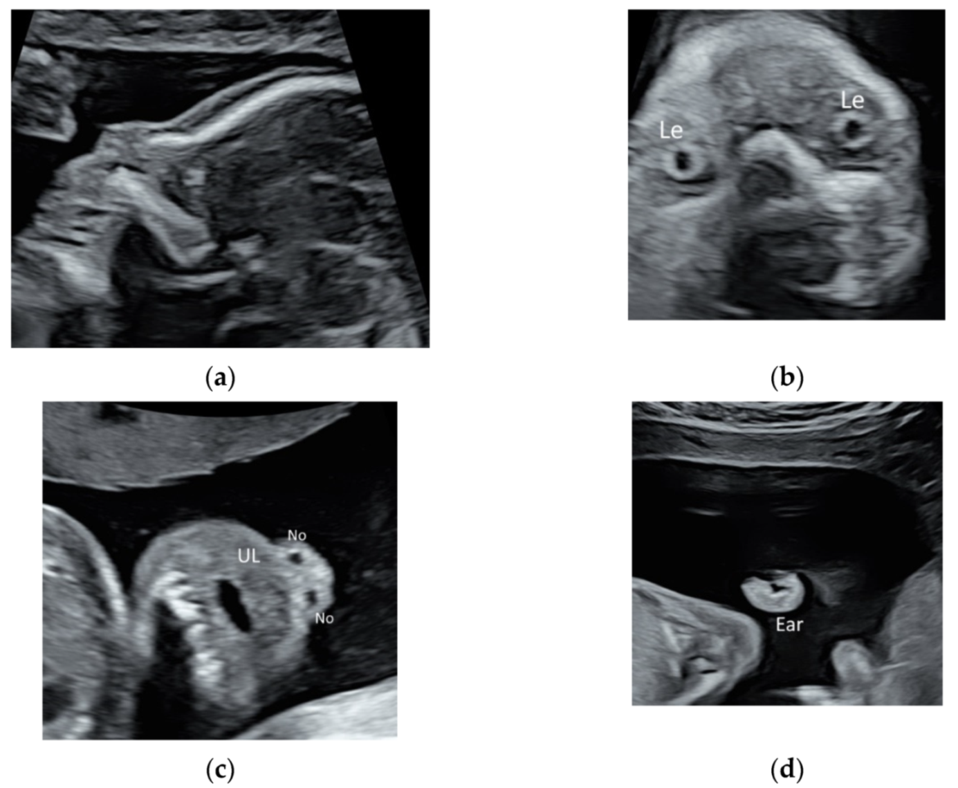 Diagnostics 11 01217 g003
