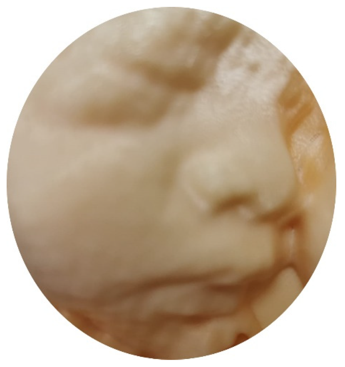 Diagnostics 11 01217 g012