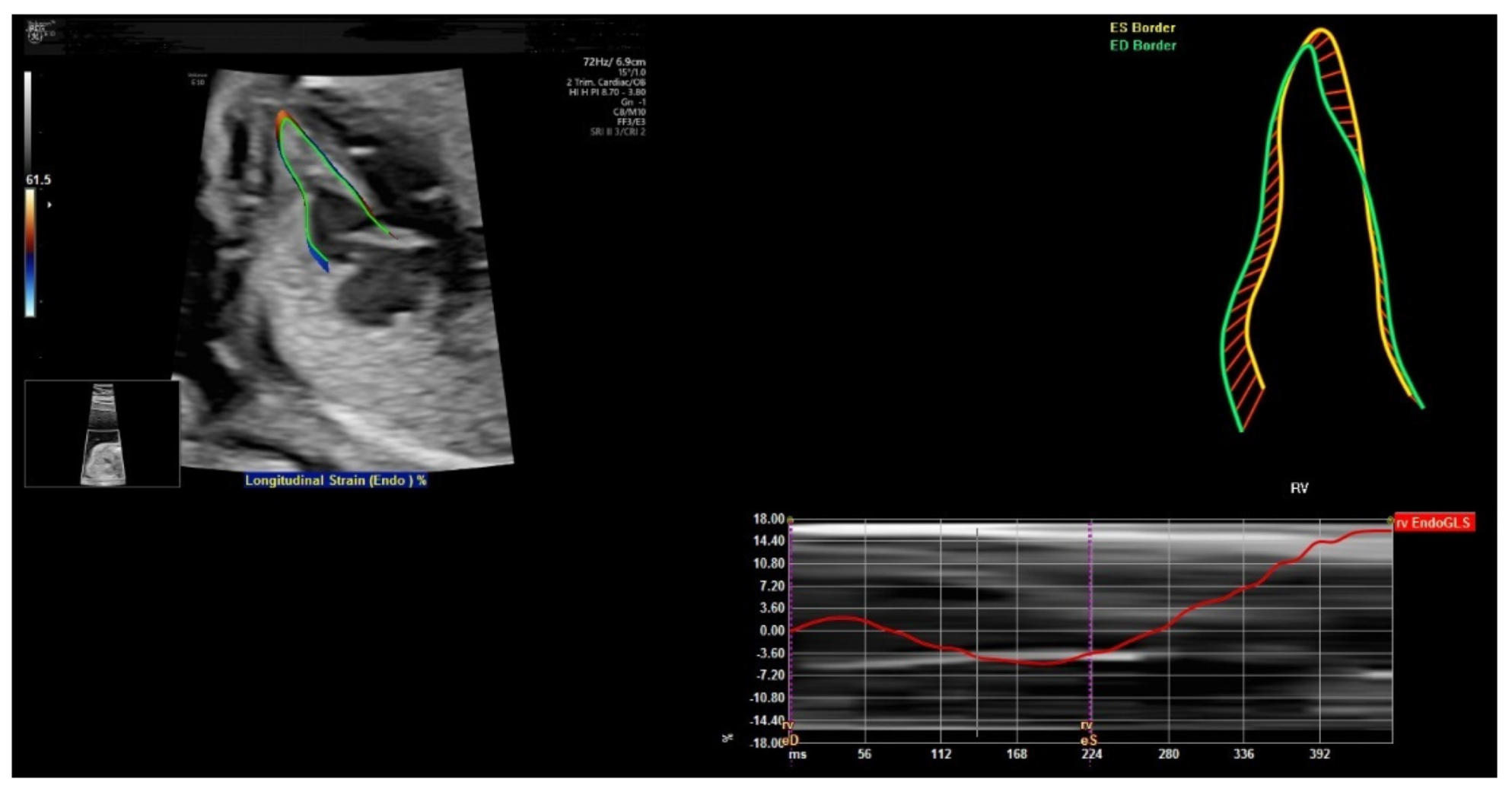 Diagnostics 11 01217 g013
