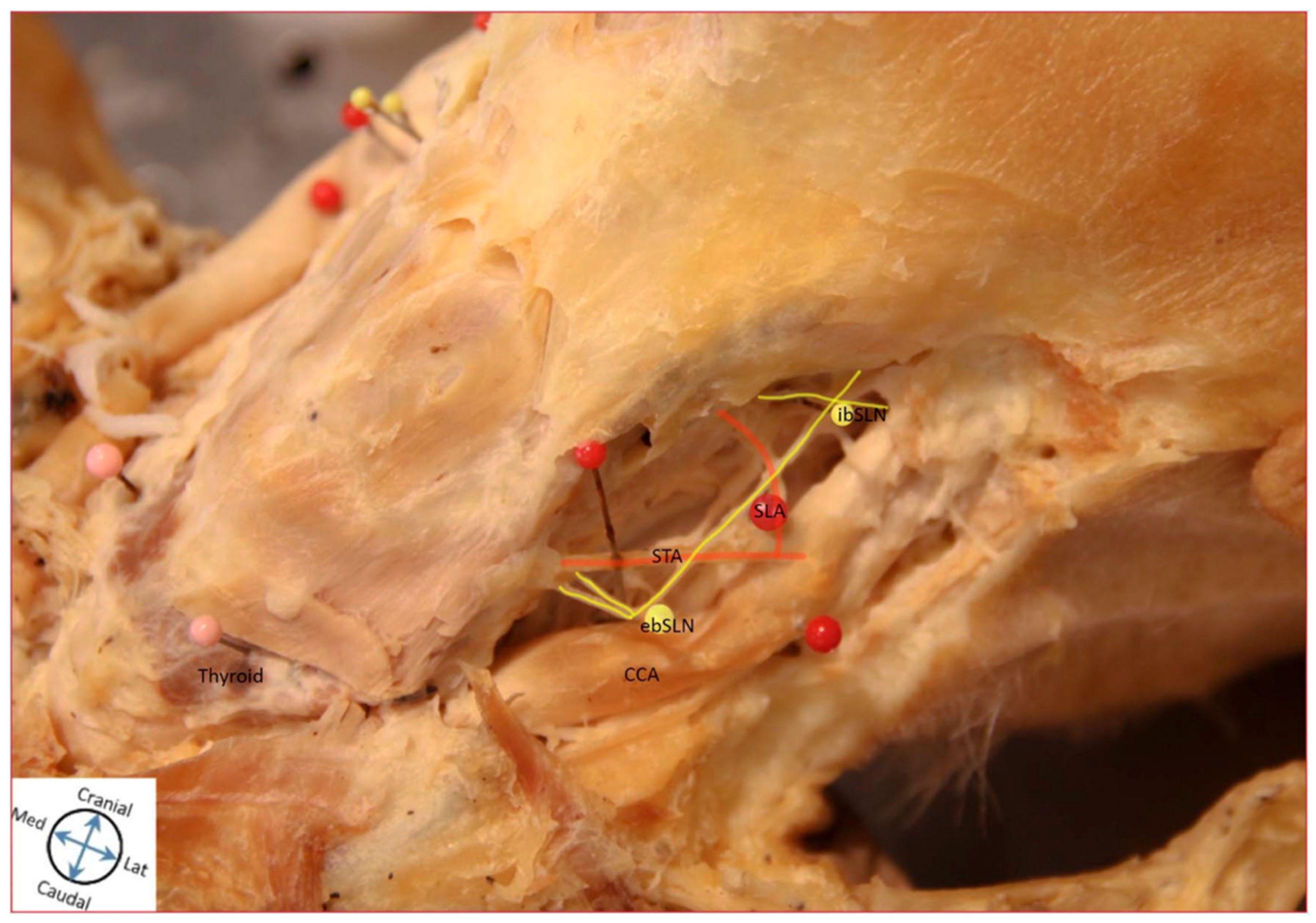 Diagnostics 11 01243 g003 550