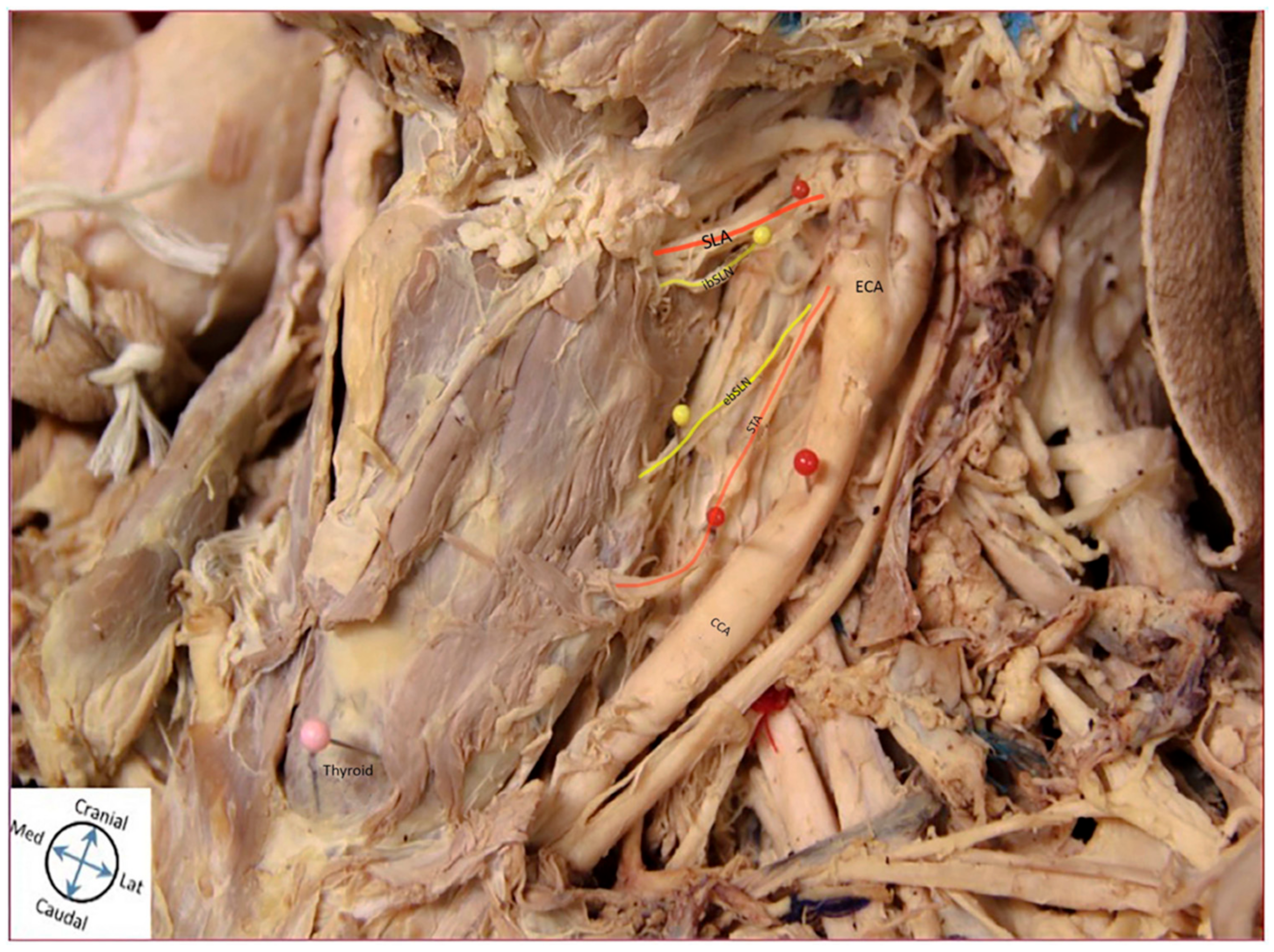 Diagnostics 11 01243 g005 550