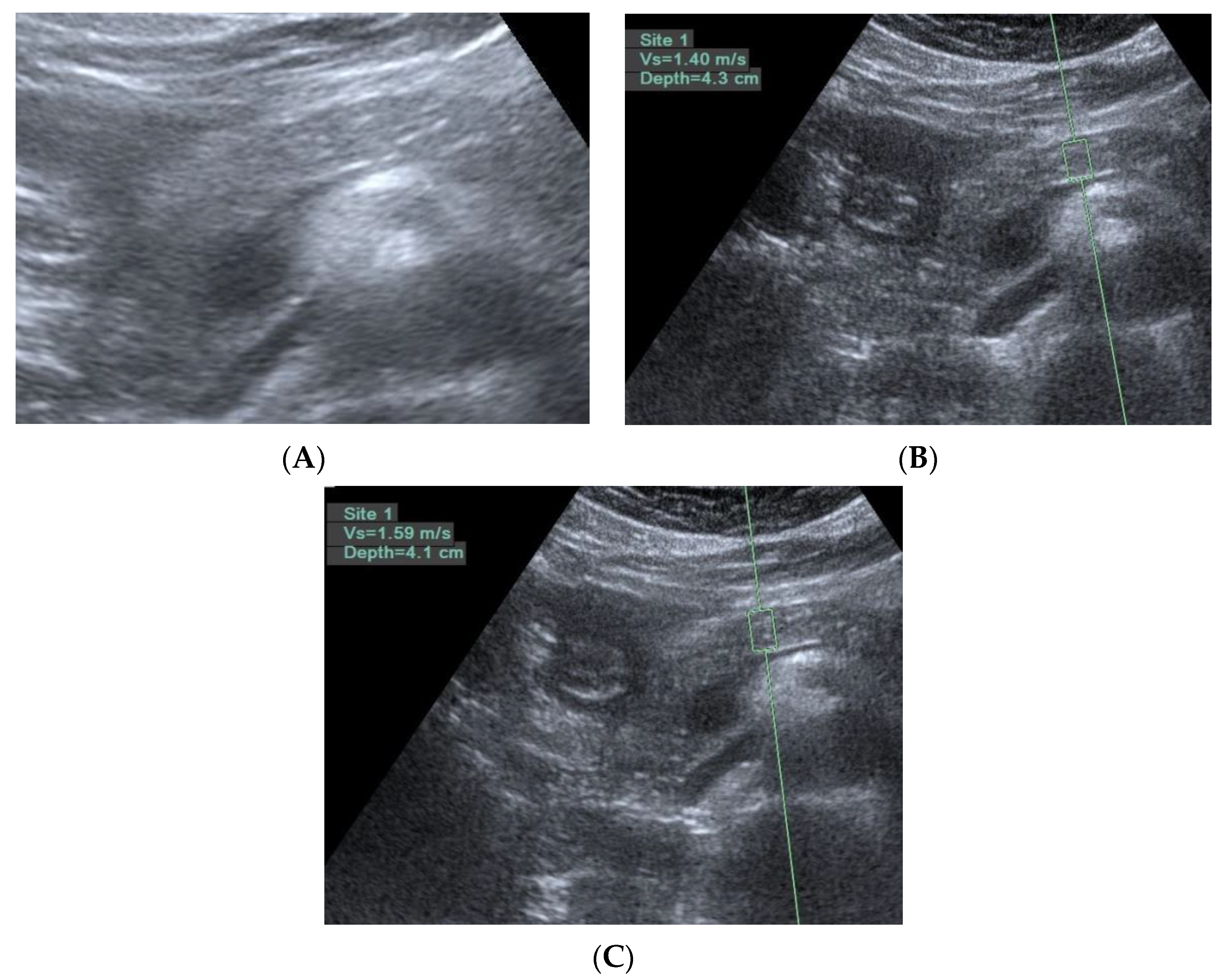 Diagnostics 11 01252 g005