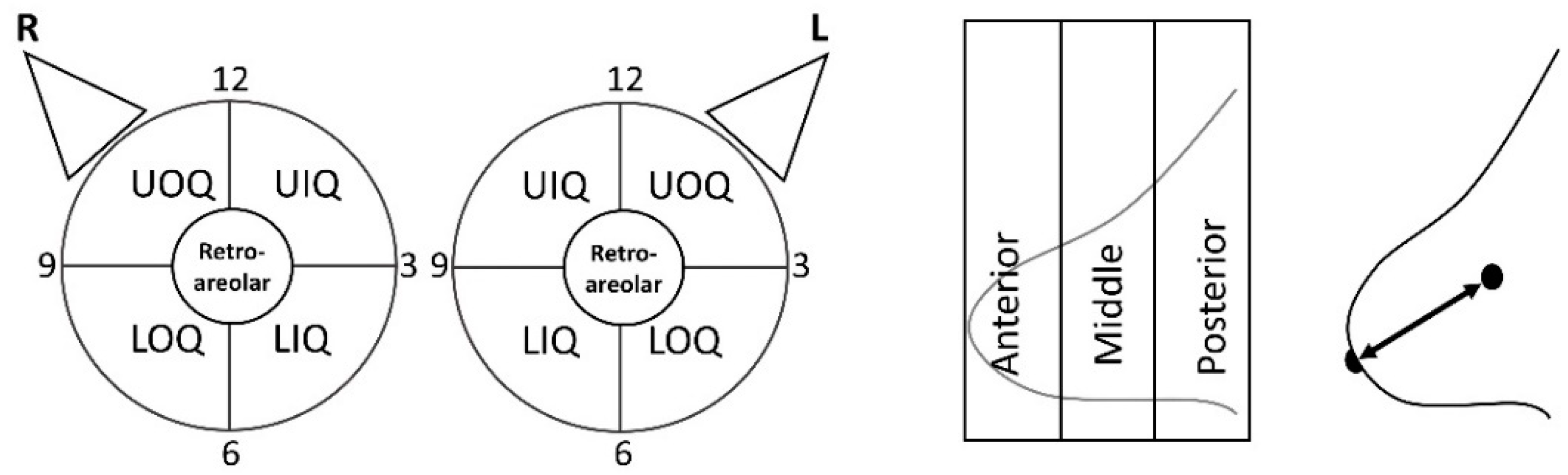 Diagnostics Free Full Text A Proposed Dedicated Breast Pet Lexicon Standardization Of Description And Reporting Of Radiotracer Uptake In The Breast Html