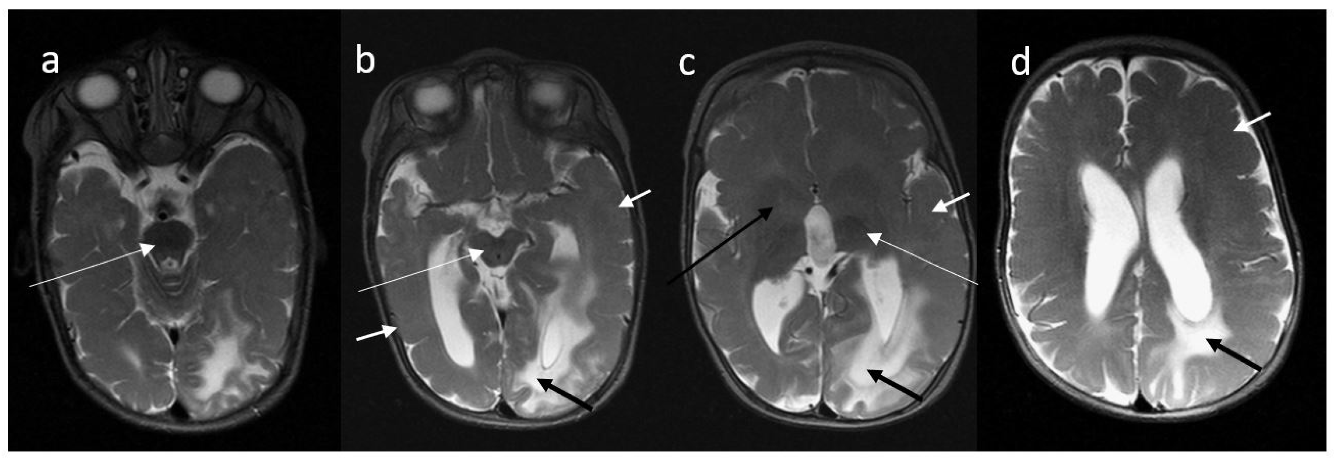 関節のMRI 世界が注目するスポーツ医学施設：JFAメディカルセンター 1.2T