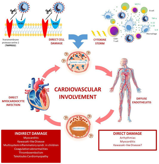 | Full-Text | Imaging Evaluation of Pulmonary Non-Ischaemic Cardiovascular Manifestations of COVID-19 | HTML