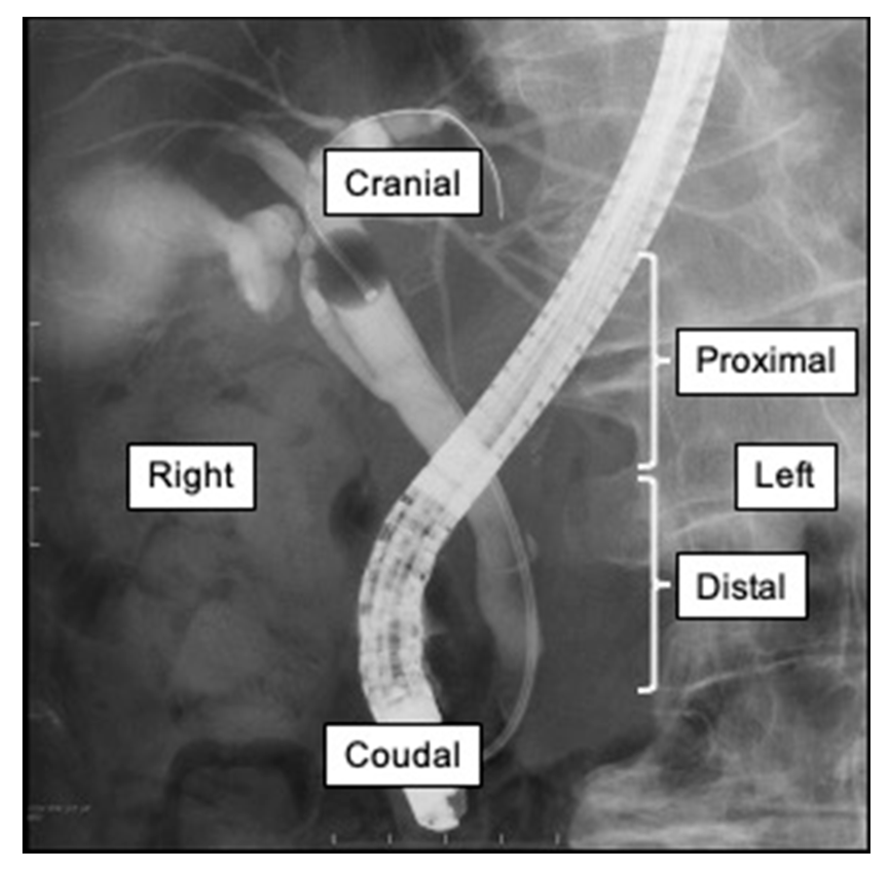 The Influence of PreProcedural Imaging and Cystic Duct Cholangiography