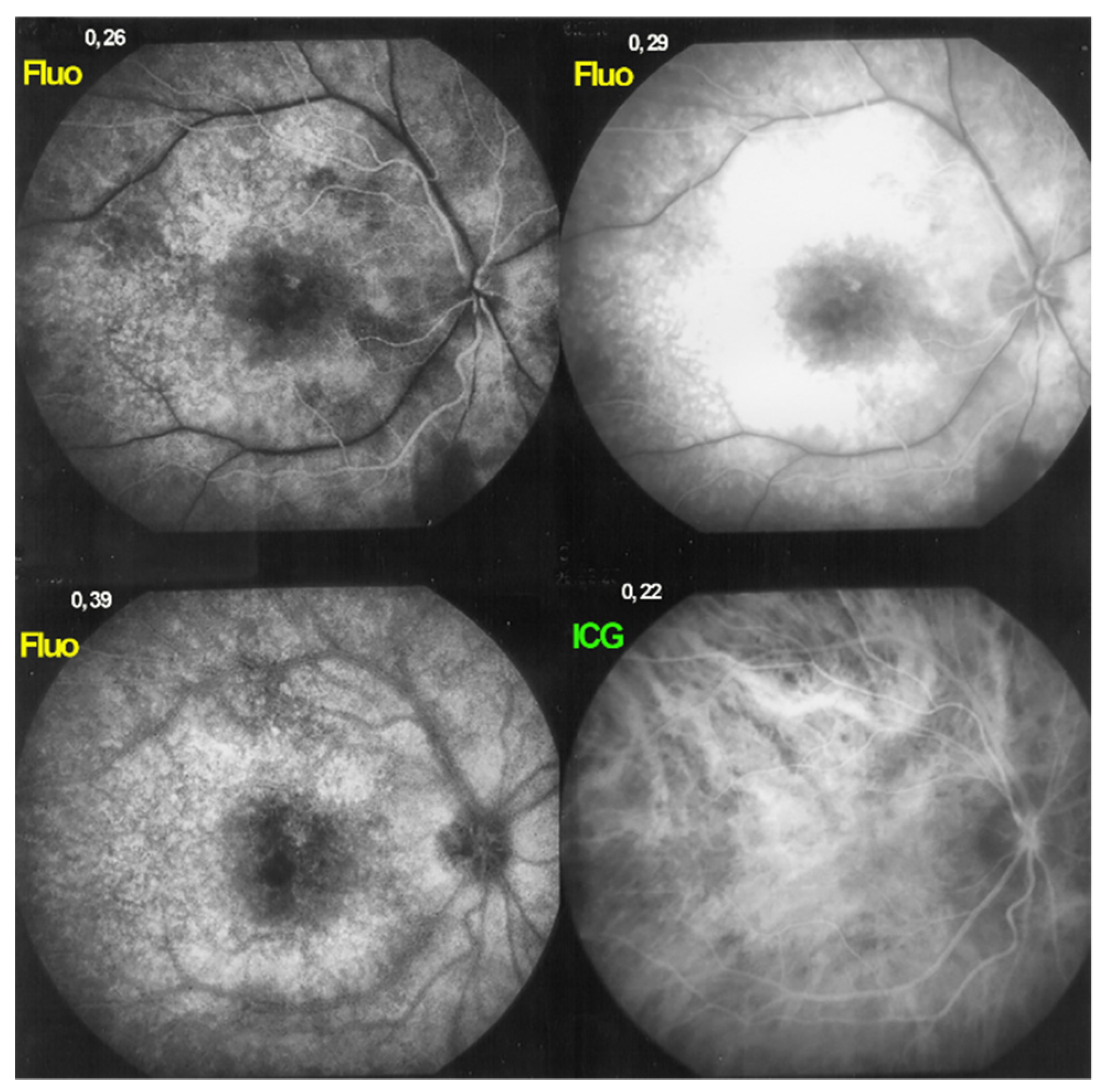 Diagnostics 11 01291 g005 Diagnostics 11 01291 g005