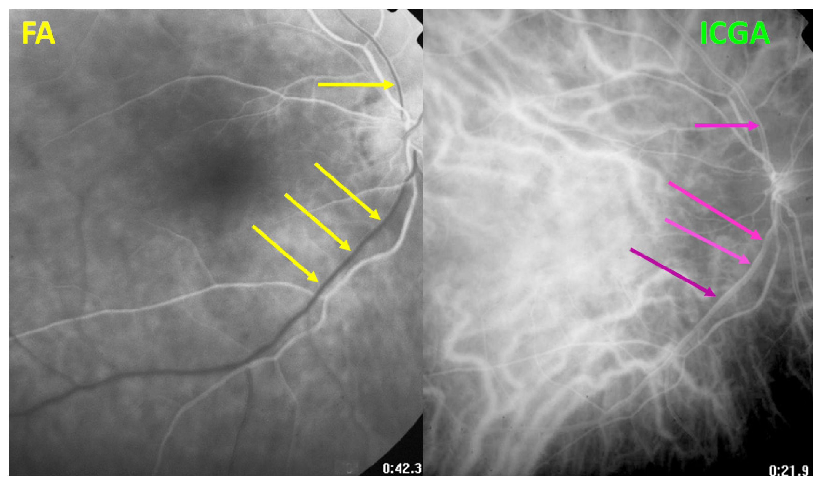 Diagnostics 11 01291 g006 Diagnostics 11 01291 g006
