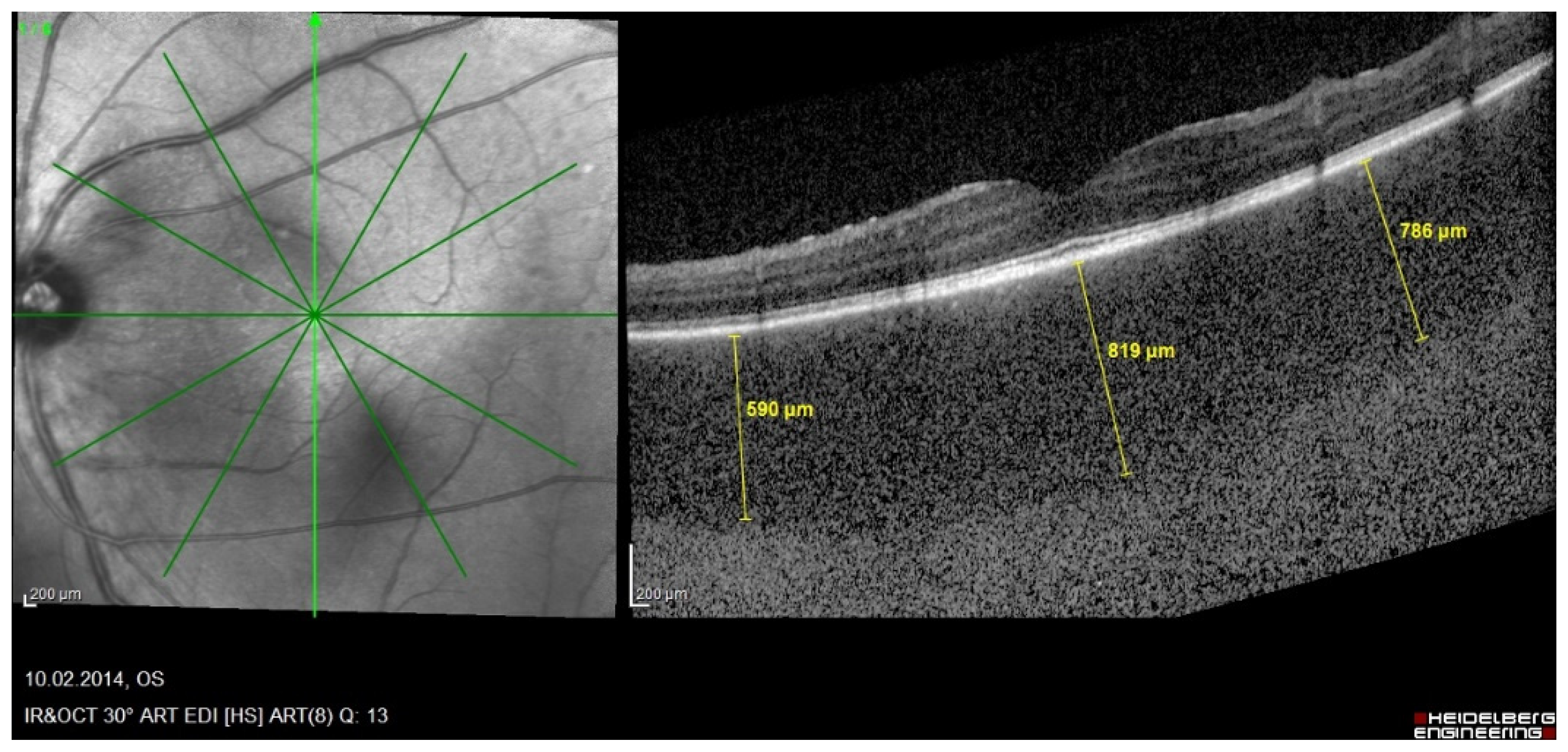 Diagnostics 11 01291 g008 Diagnostics 11 01291 g008