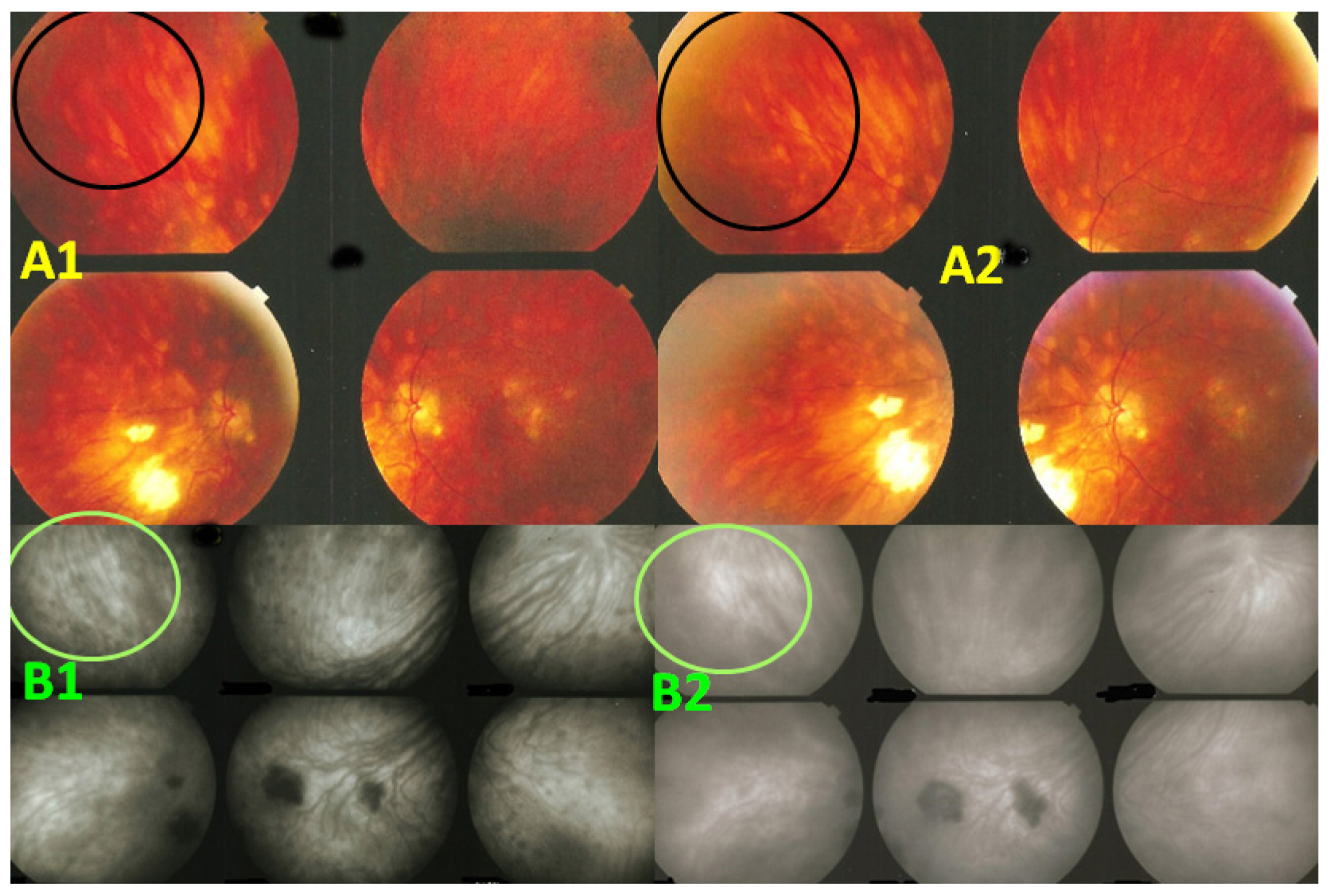 Diagnostics 11 01291 g012 Diagnostics 11 01291 g012
