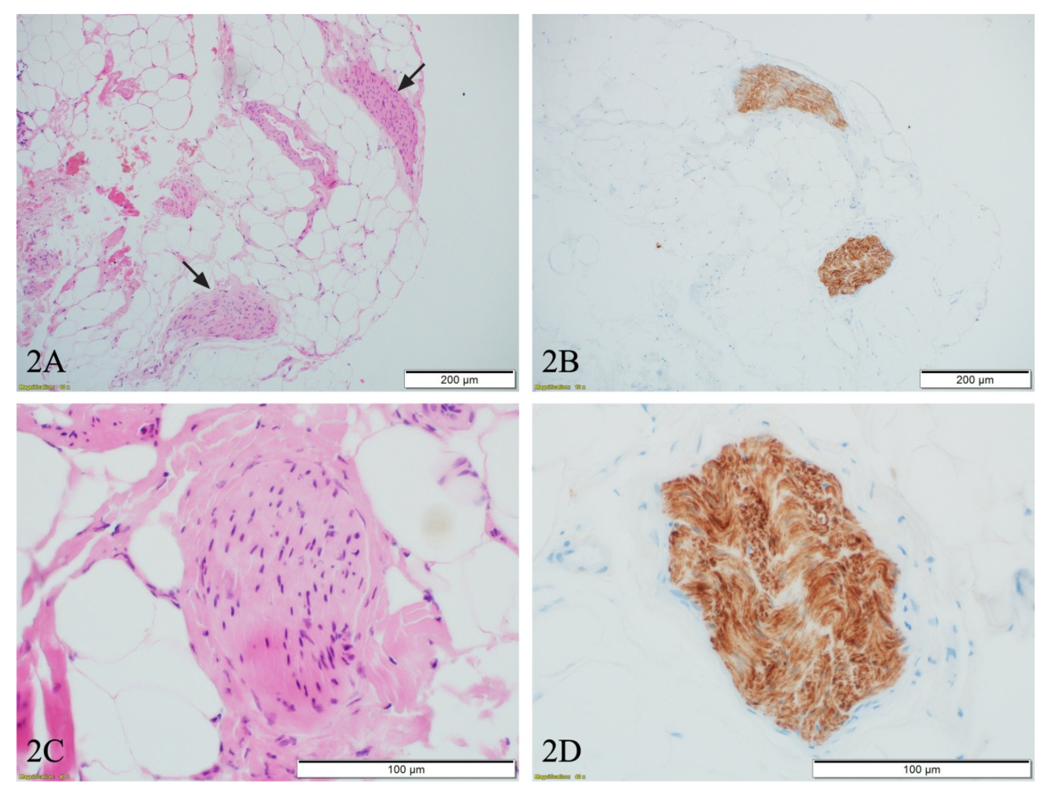 Diagnostics 11 01308 g002 550