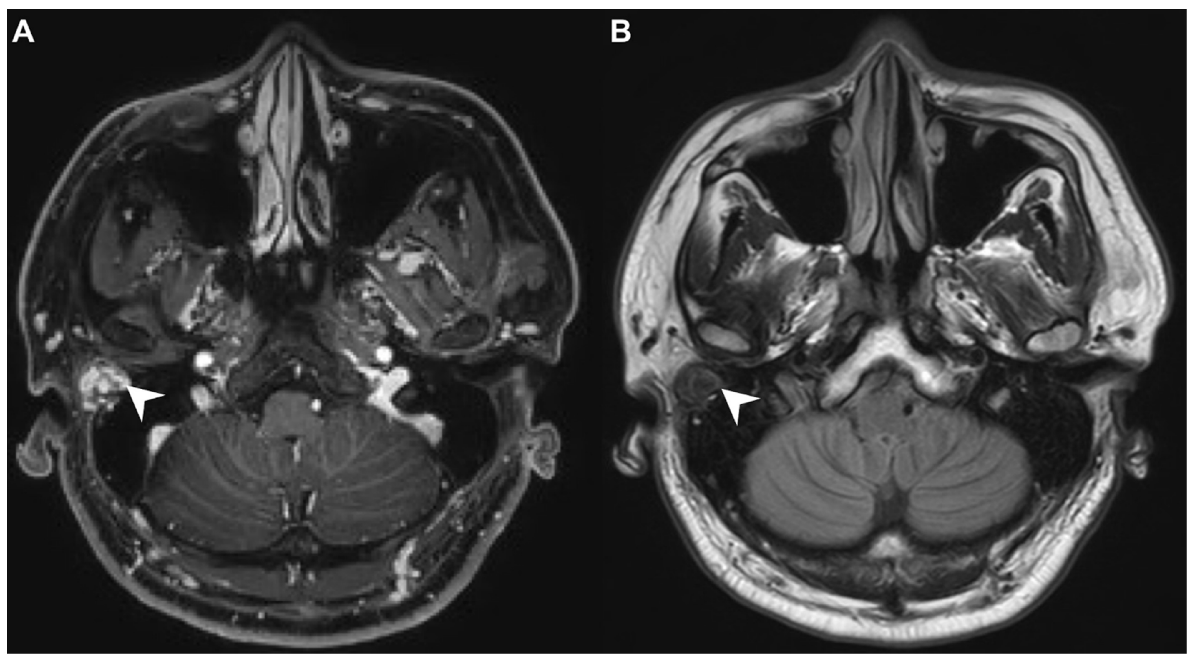 Diagnostics 11 01312 g003 Diagnostics 11 01312 g003