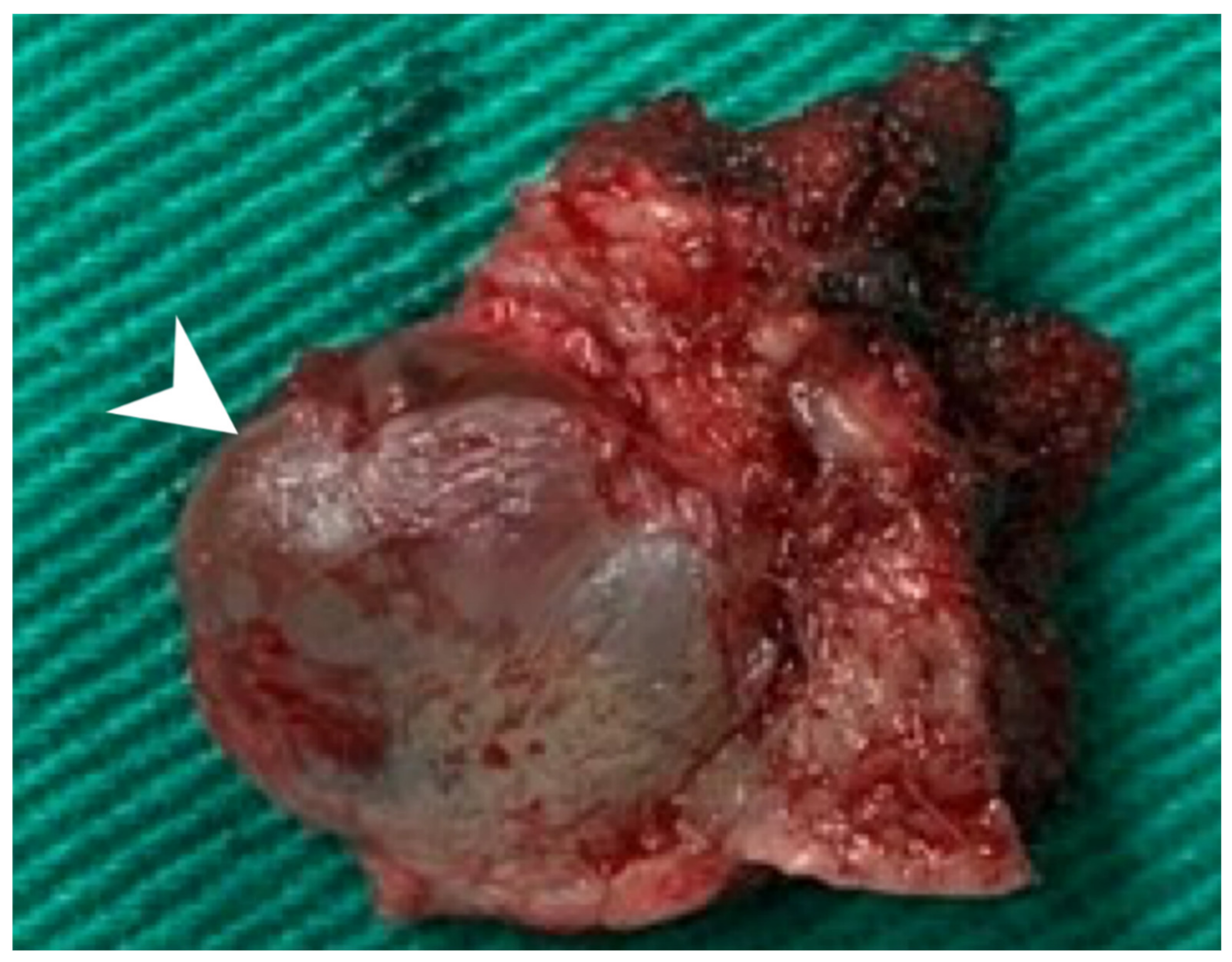 Diagnostics 11 01312 g004 Diagnostics 11 01312 g004