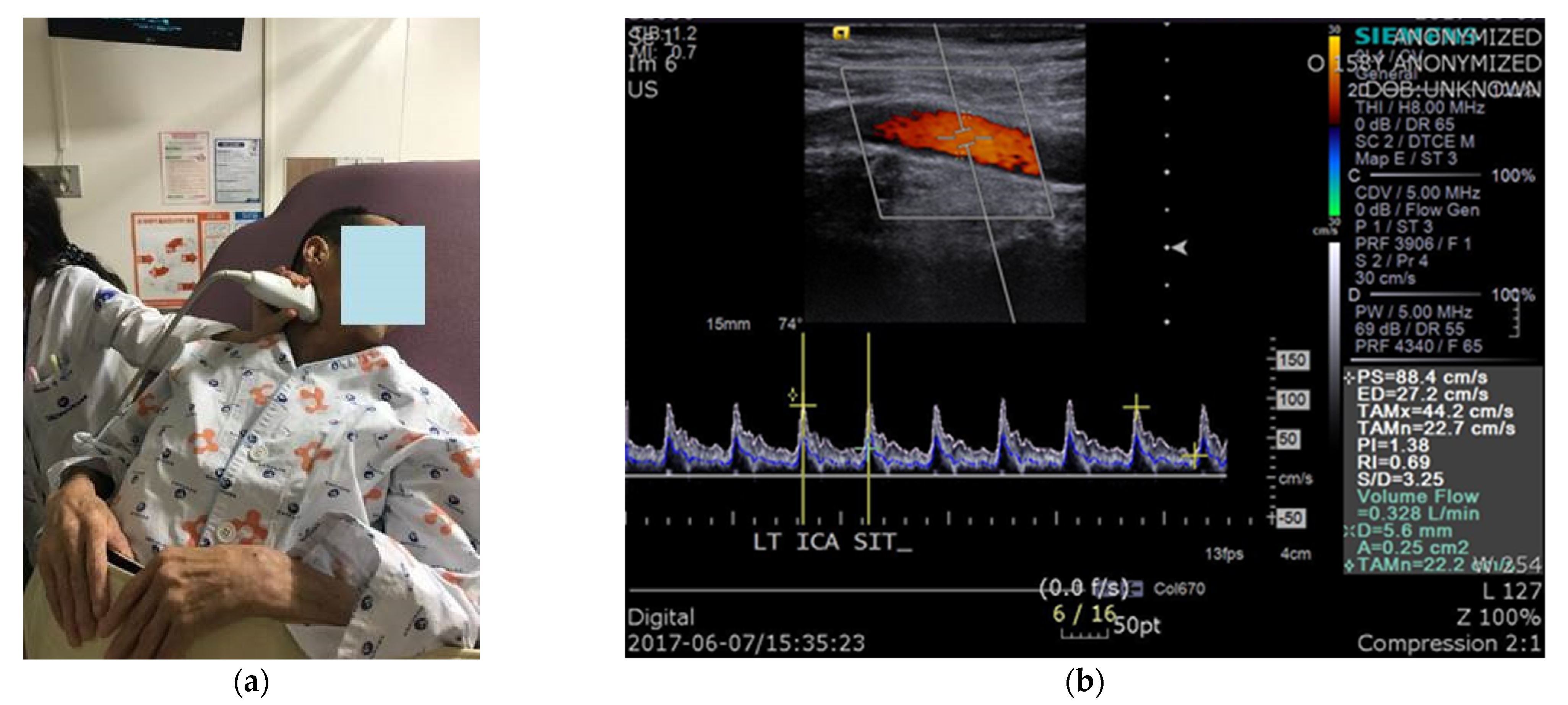 Diagnostics 11 01321 g001