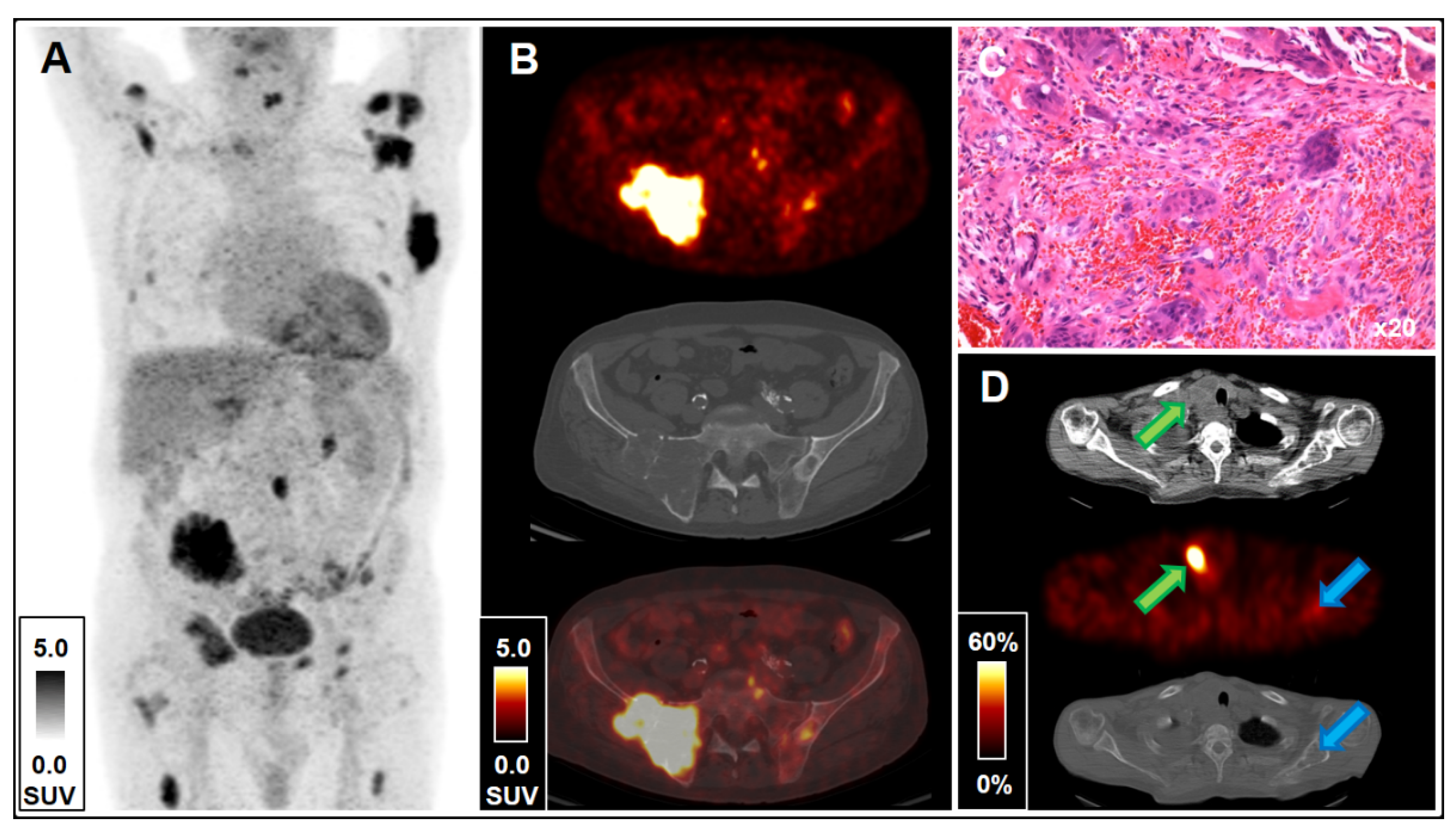Molecular Imaging with 18F-FDG PET/CT and 99mTc-MIBI SPECT