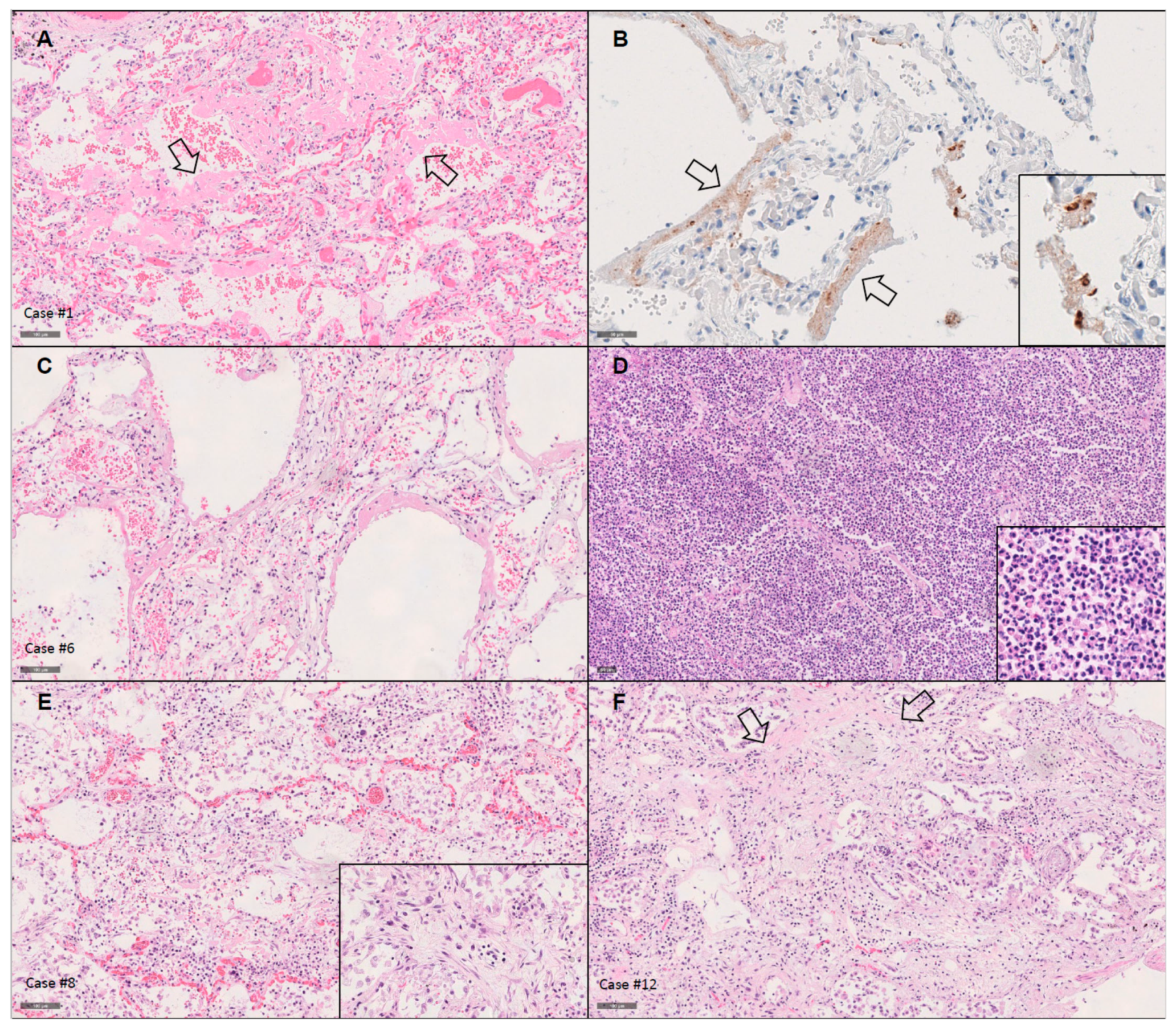 Diagnostics 11 01357 g001 Diagnostics 11 01357 g001