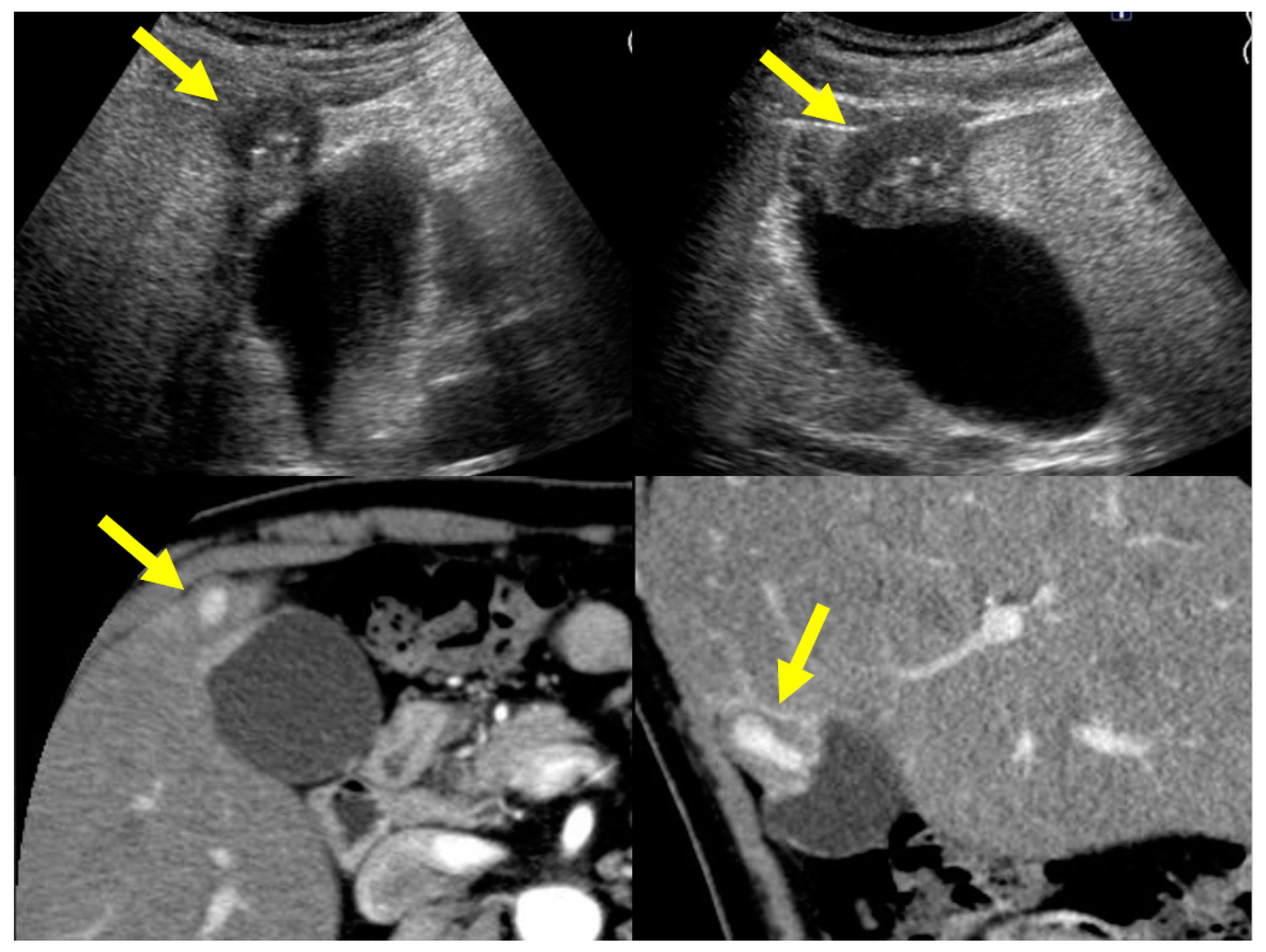 Diagnostics 11 01358 g008 Diagnostics 11 01358 g008