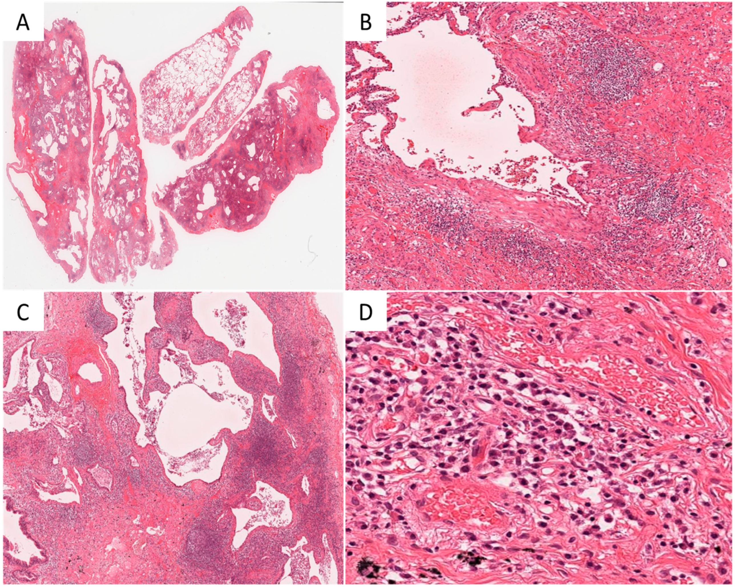 Diagnostics 11 01359 g002 550