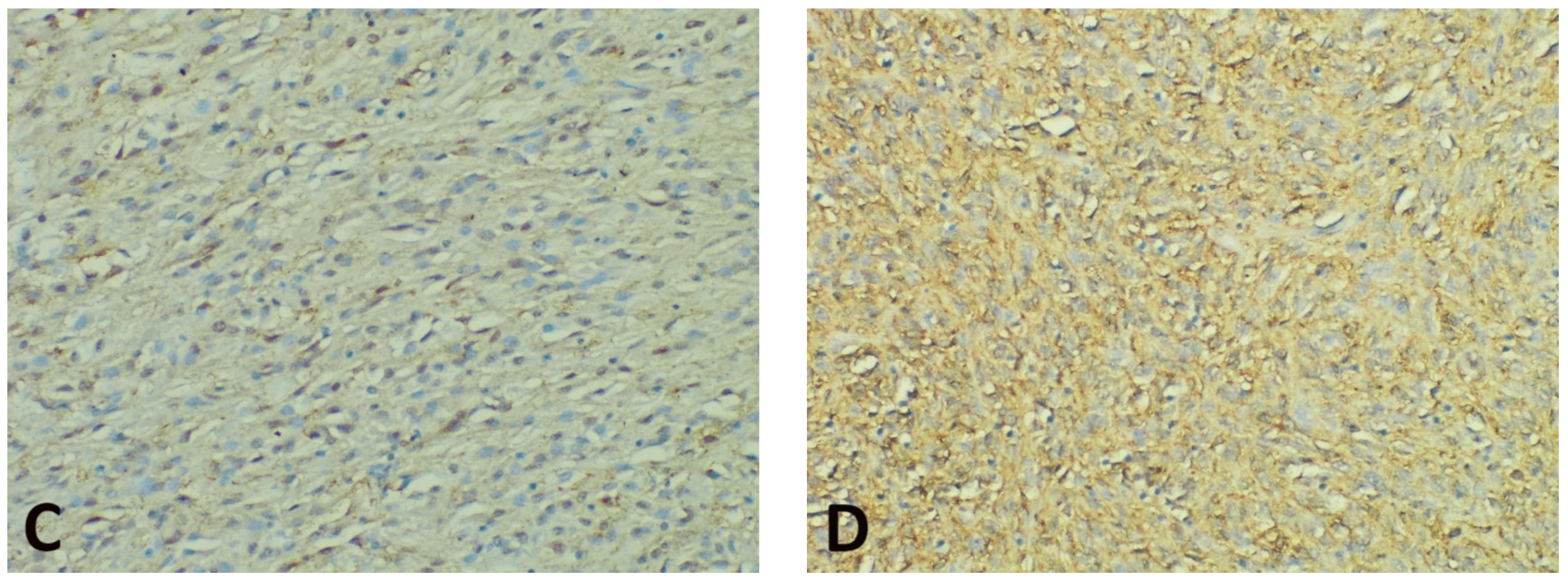 Diagnostics 11 01361 g003b