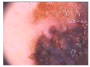 Diagnostics 11 01366 i433