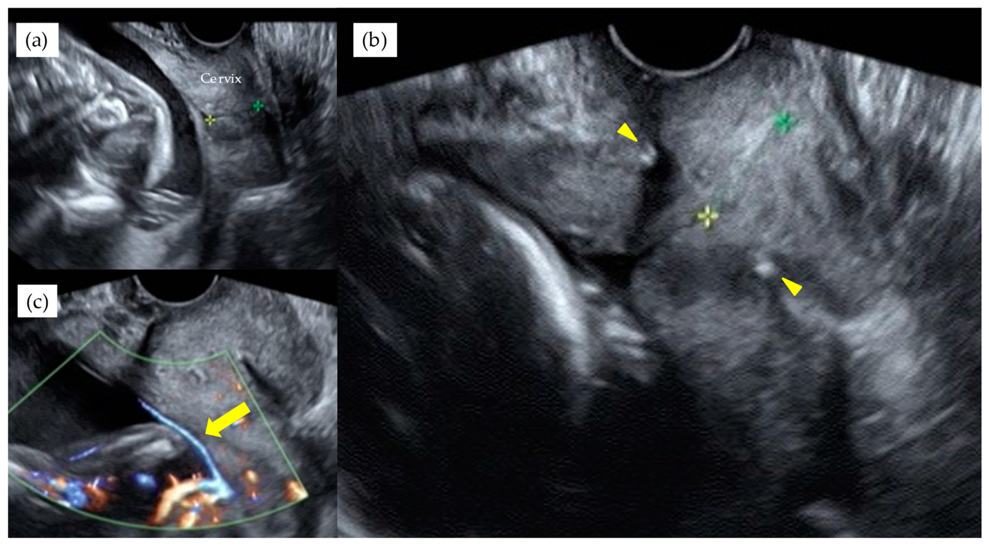 Diagnostics 11 01369 g003 550