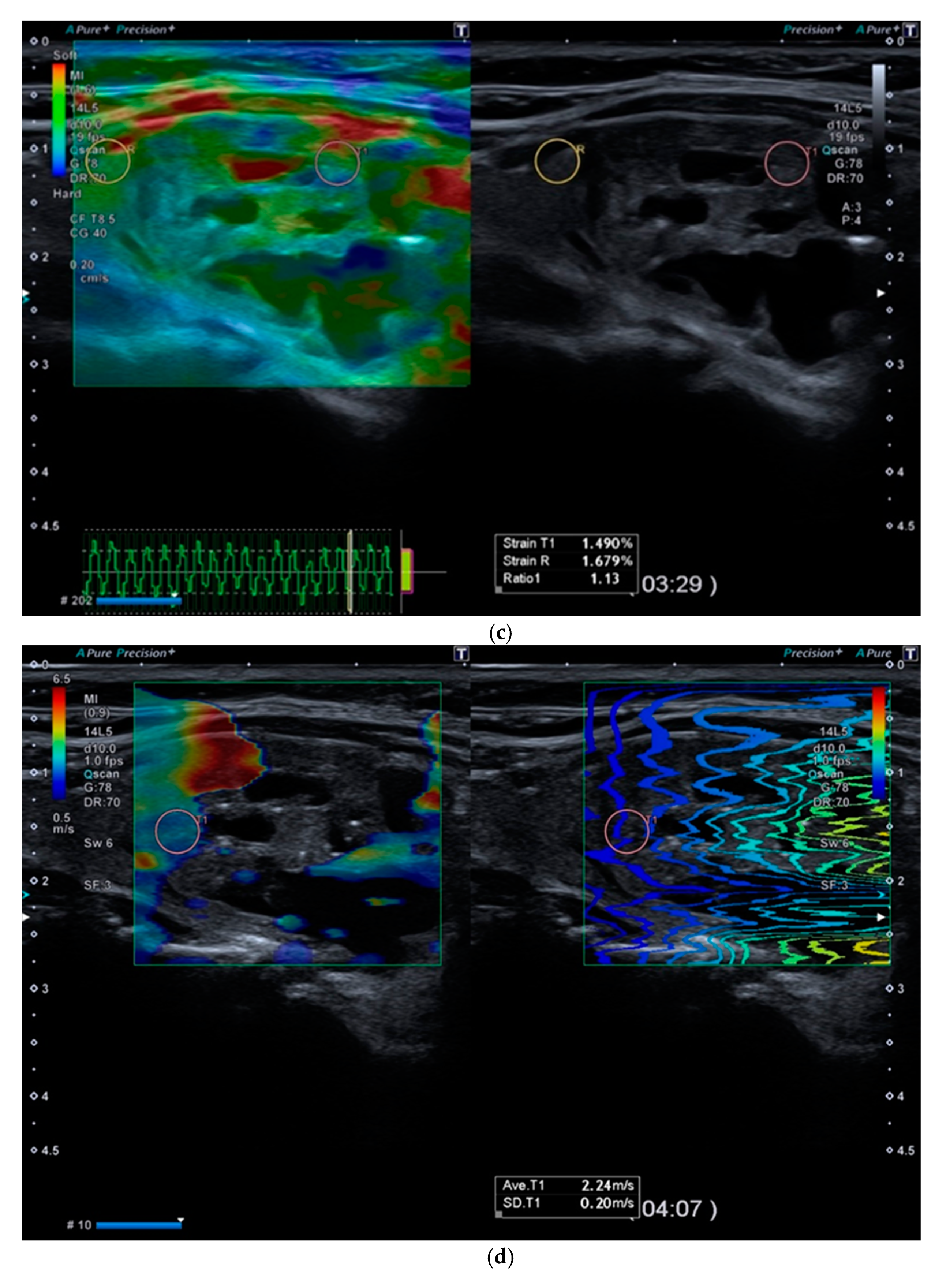 Diagnostics 11 01374 g002b
