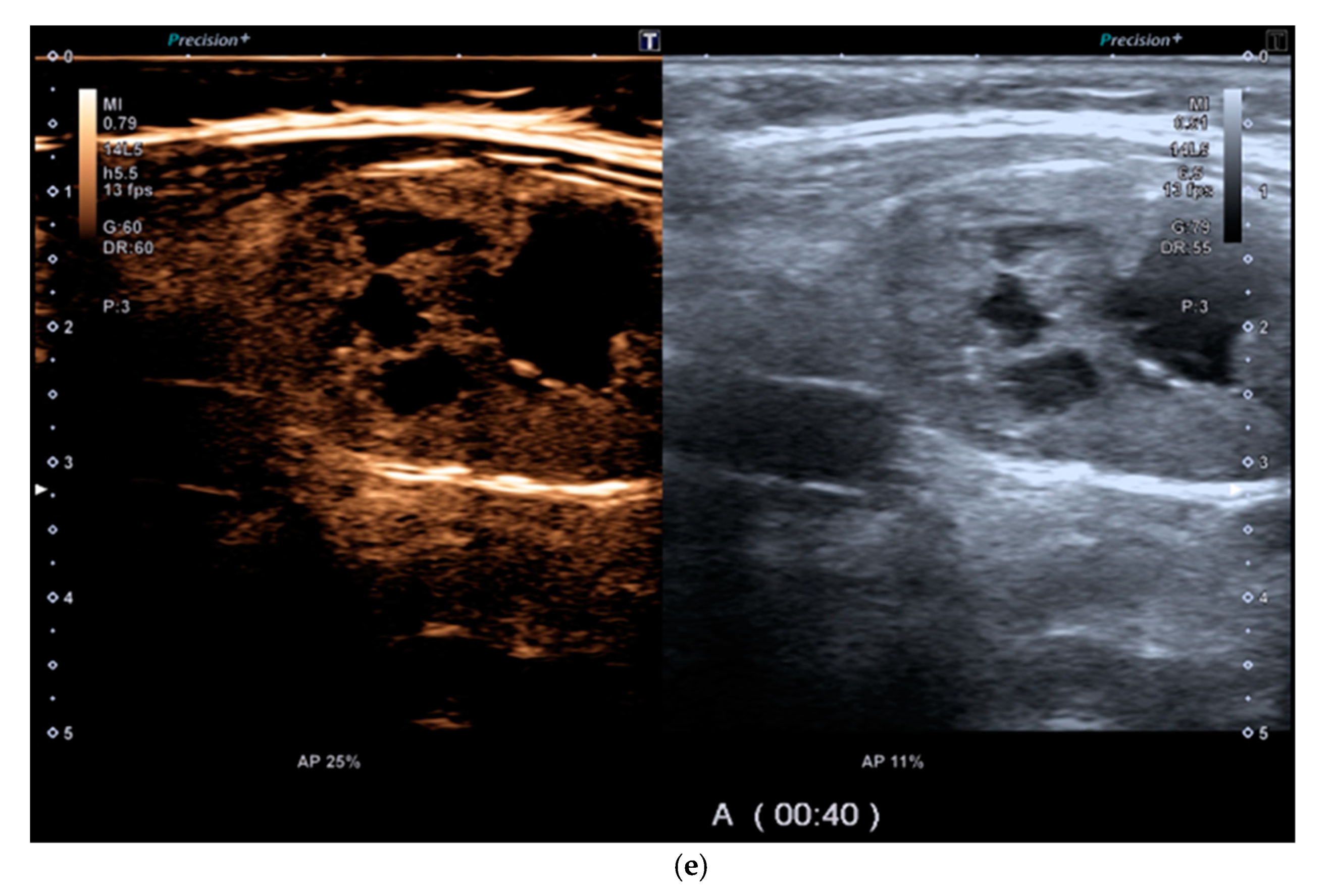 Diagnostics 11 01374 g002c