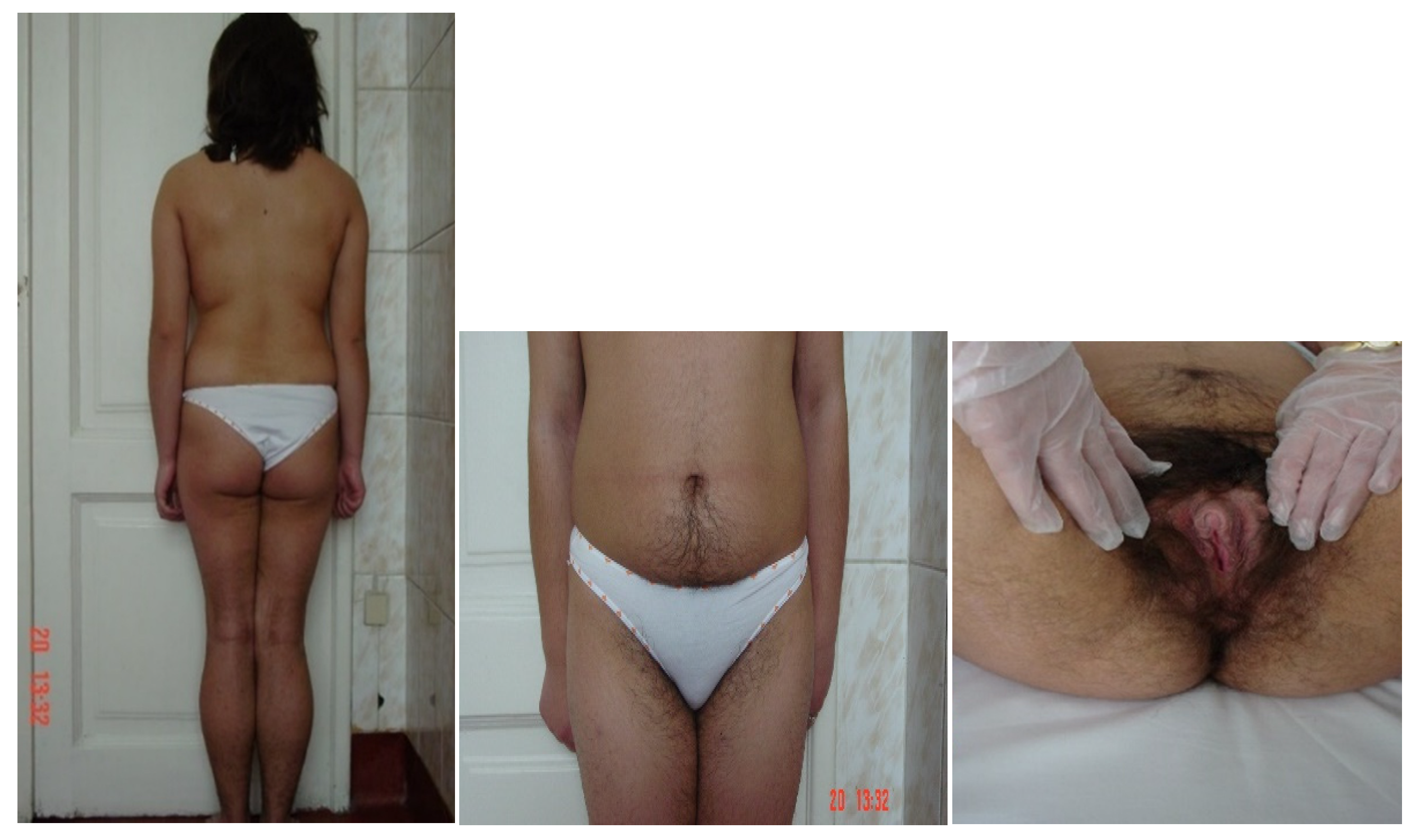 Diagnostics 11 01379 g009 Diagnostics 11 01379 g009