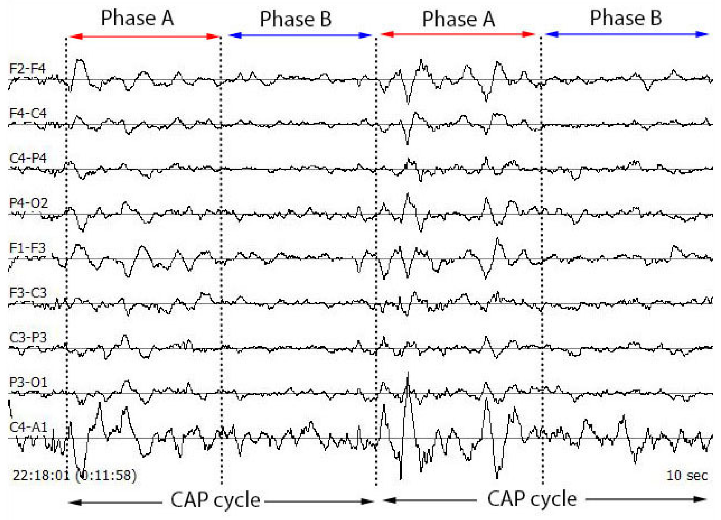 Diagnostics Free FullText Automated Characterization of Cyclic