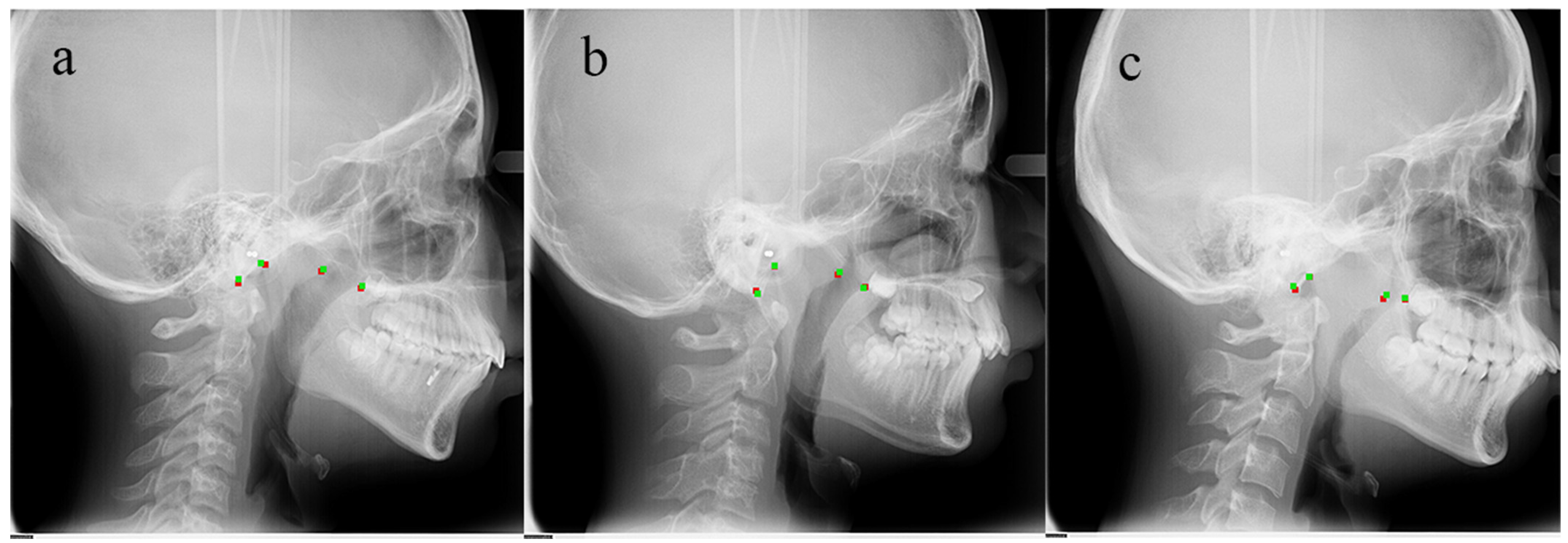 Diagnostics 11 01386 g008 550