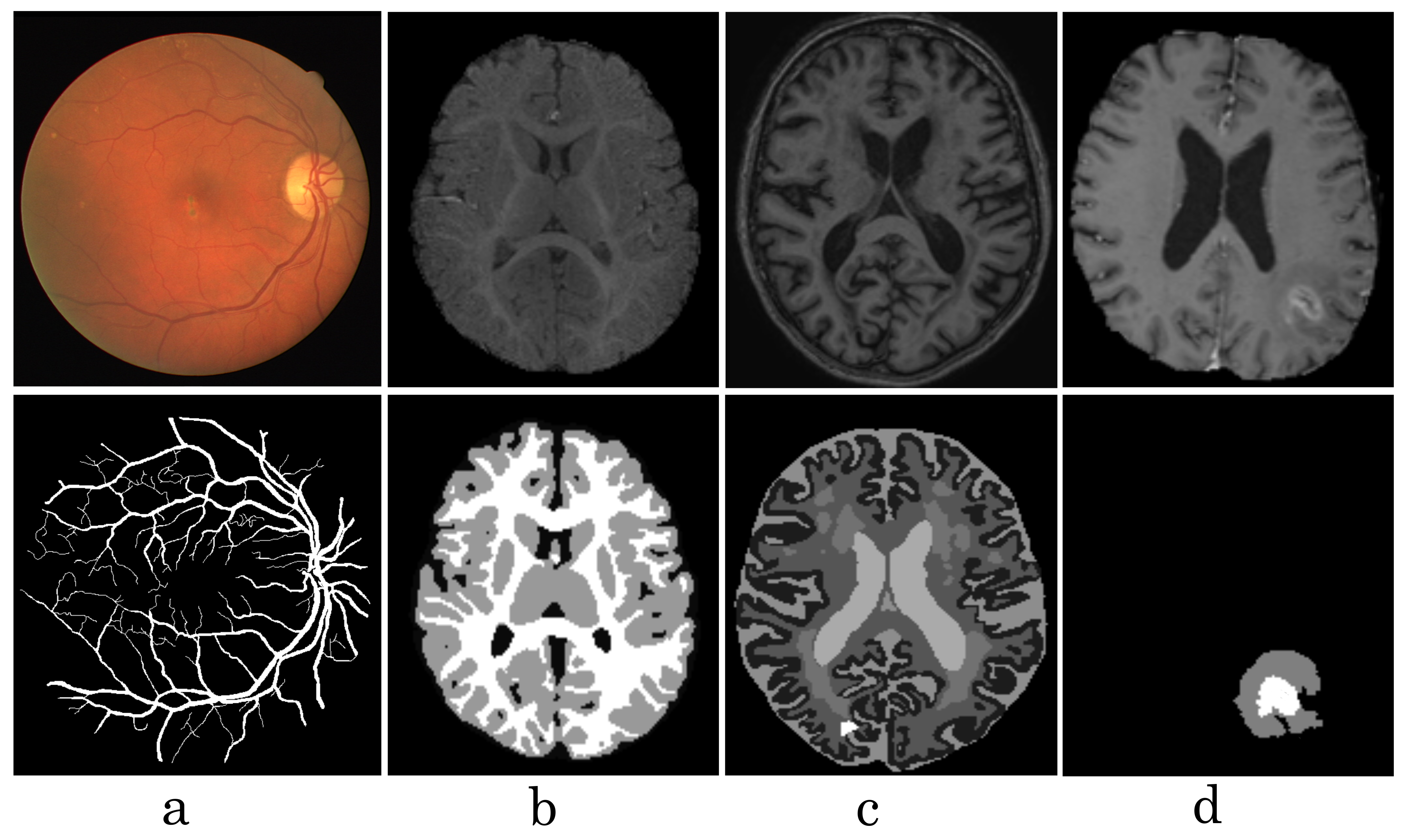 Diagnostics Free Full Text Narrow Band Active Contour Attention Model For Medical Segmentation Html