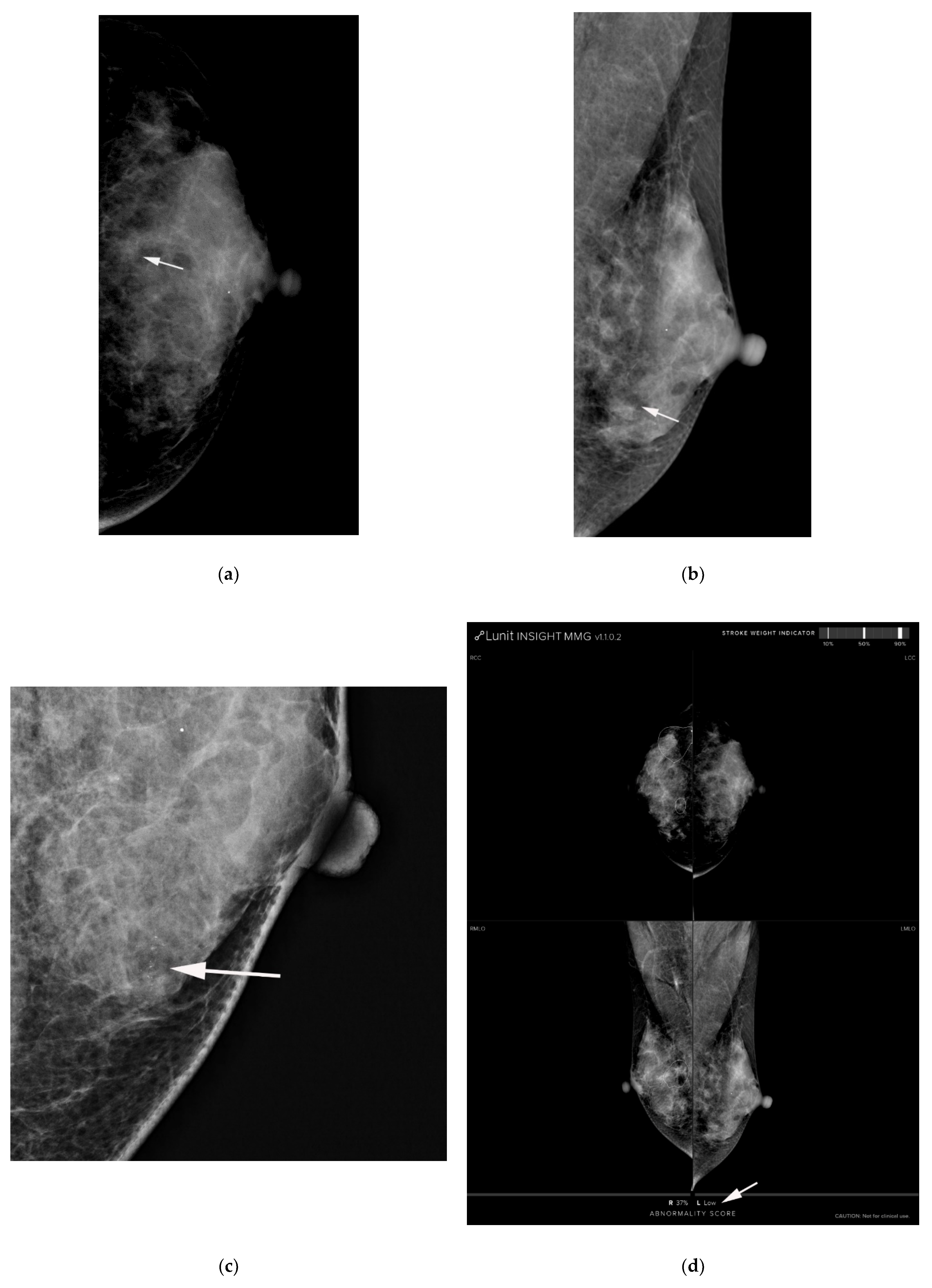 Diagnostics 11 01409 g003