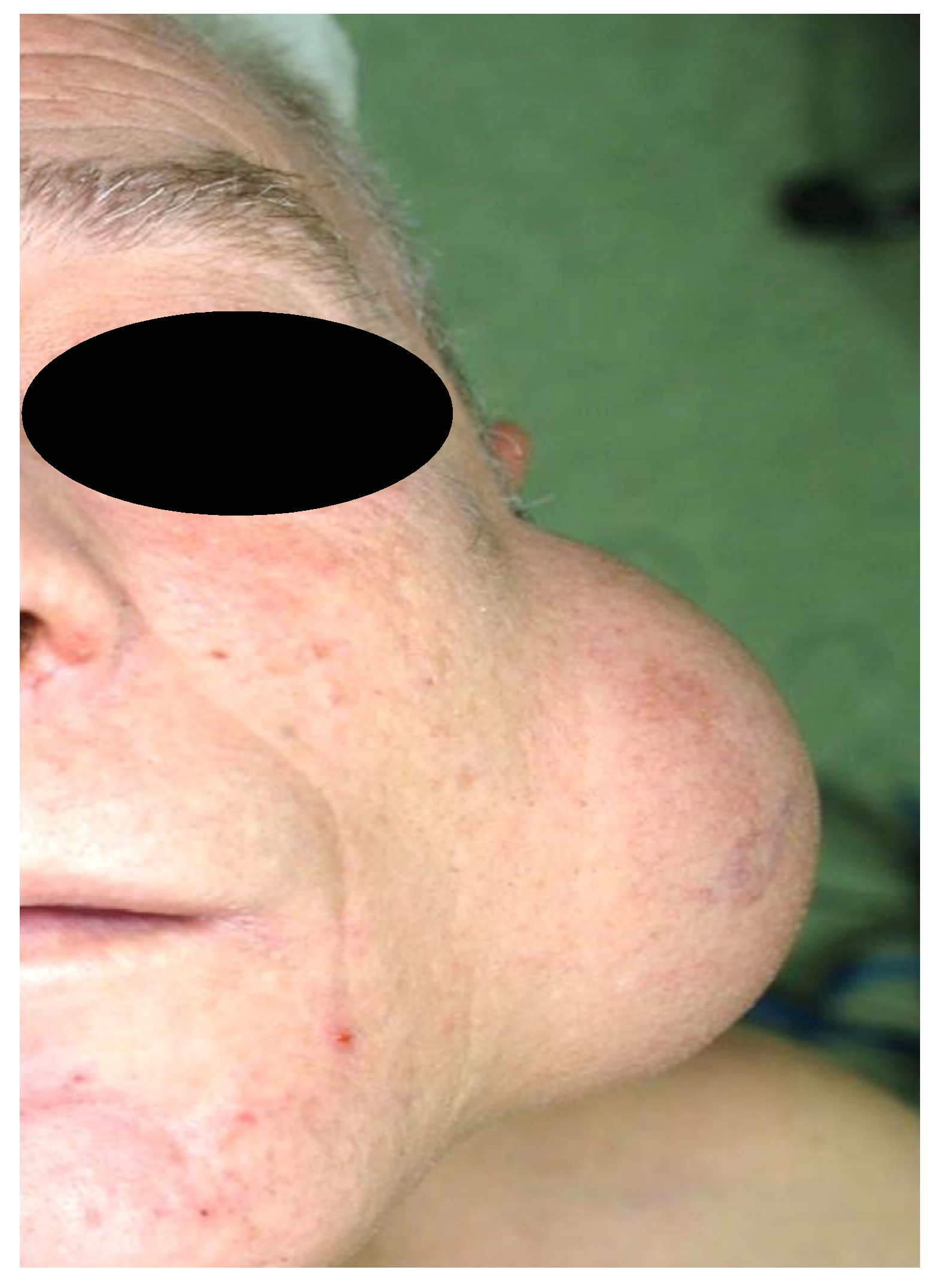 Diagnostics 11 01467 g004 Diagnostics 11 01467 g004