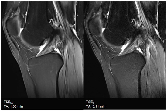 裁断済 Diagnostic Imaging: Musculoskeletal 裁断済 Diagnostic Imaging: Musculoskeletal Diagnostic