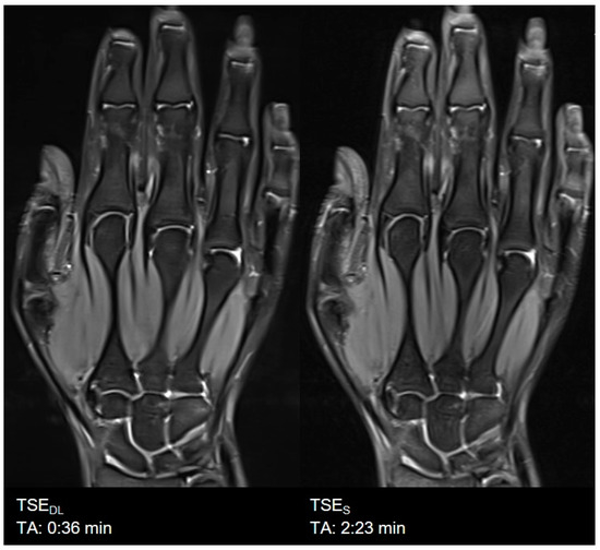 裁断済 Diagnostic Imaging: Musculoskeletal Diagnostic Imaging: Musculoskeletal Non-Traumati