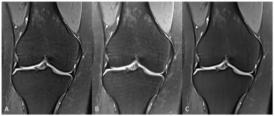 裁断済 Diagnostic Imaging: Musculoskeletal Musculoskeletal Imaging: The Requisites: The Requisites