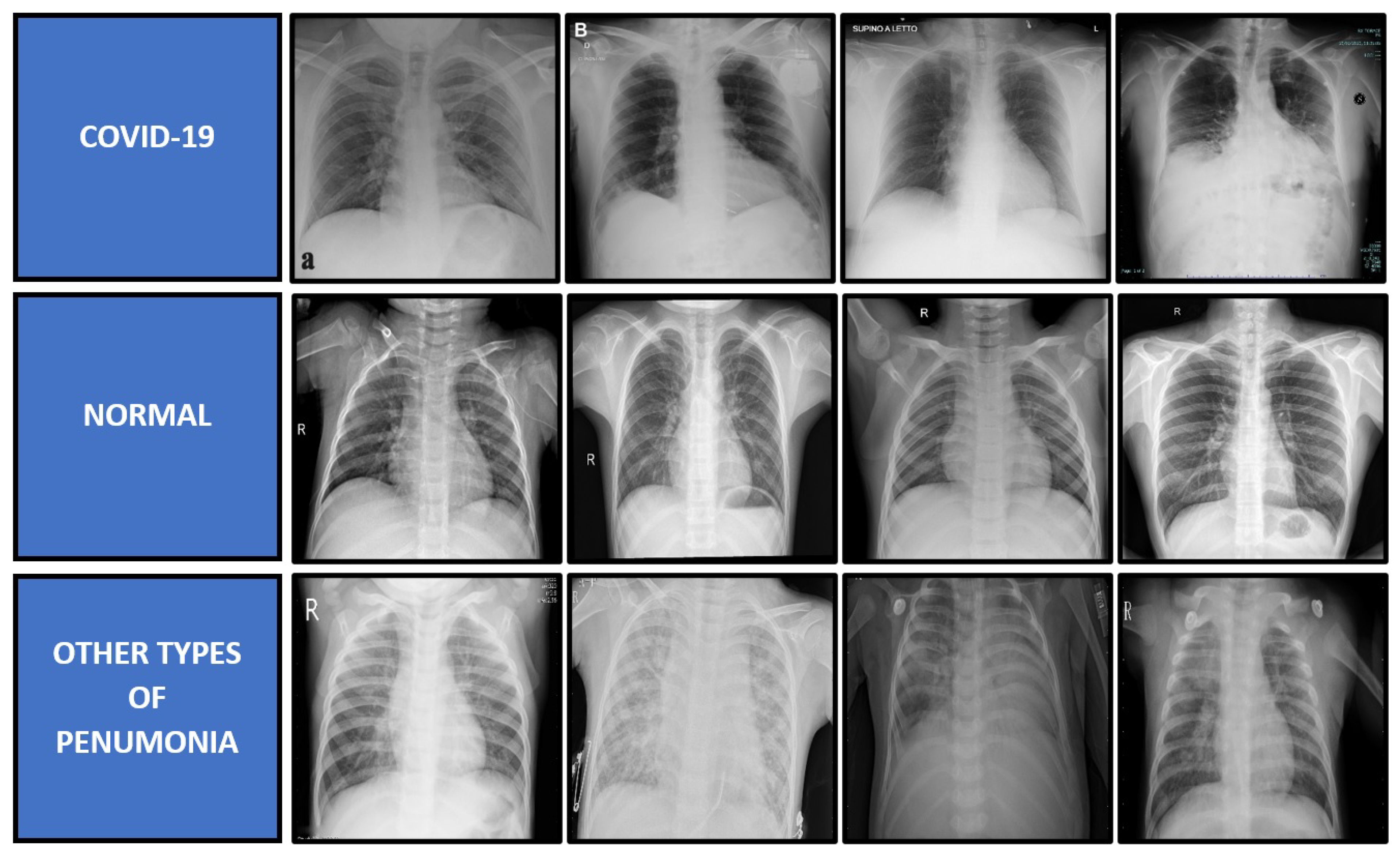 Diagnostics 11 01497 g004 550