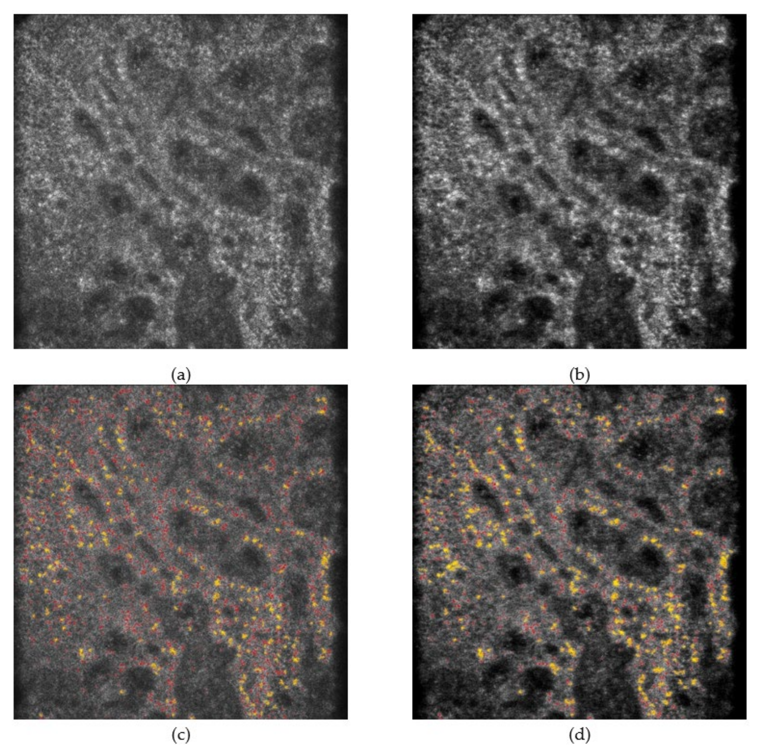 Diagnostics 11 01498 g007 550