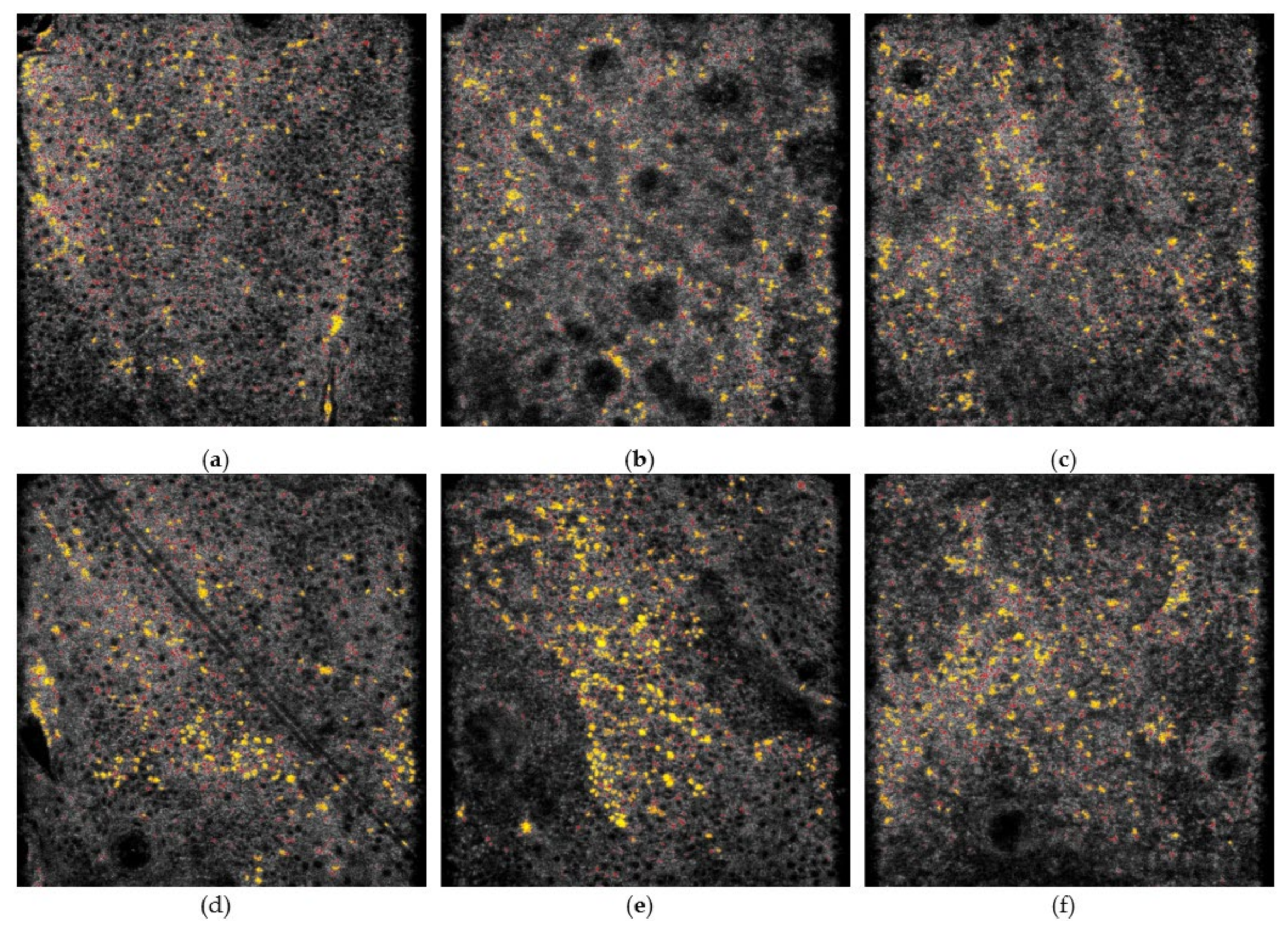Diagnostics 11 01498 g008 550