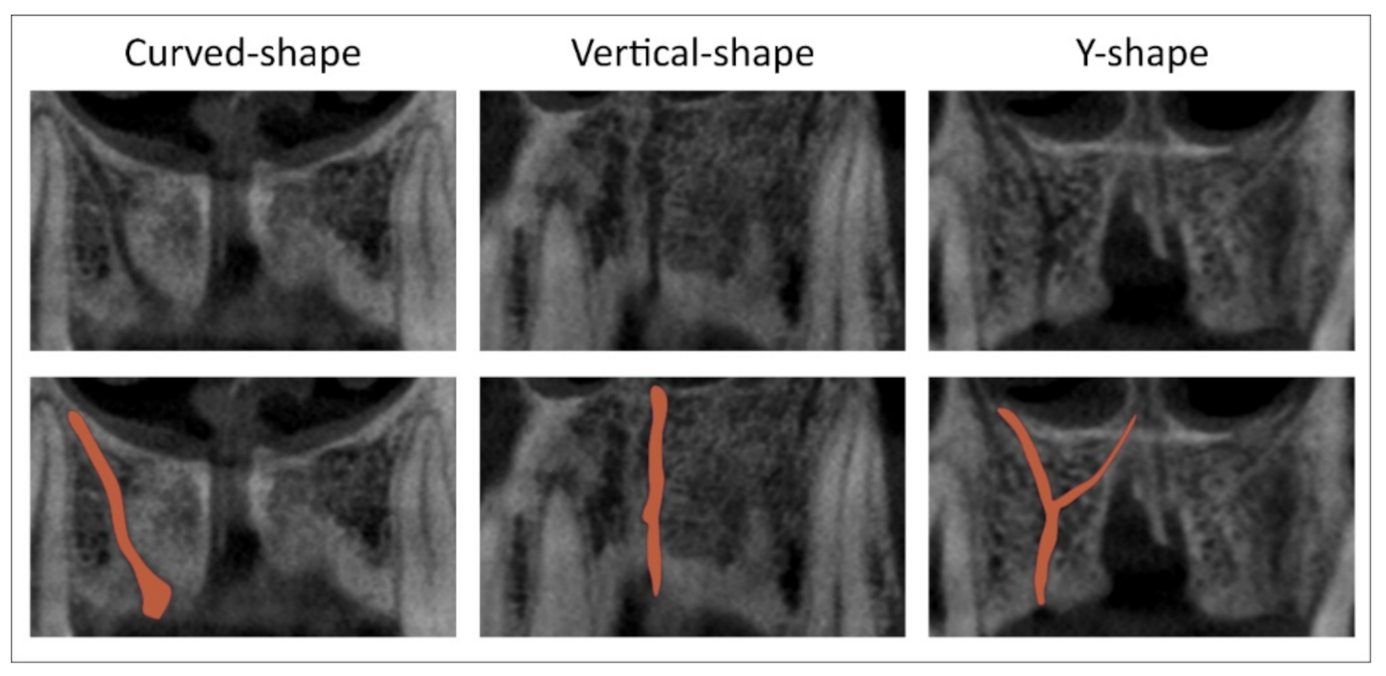 Diagnostics Free FullText Morphological and Morphometric