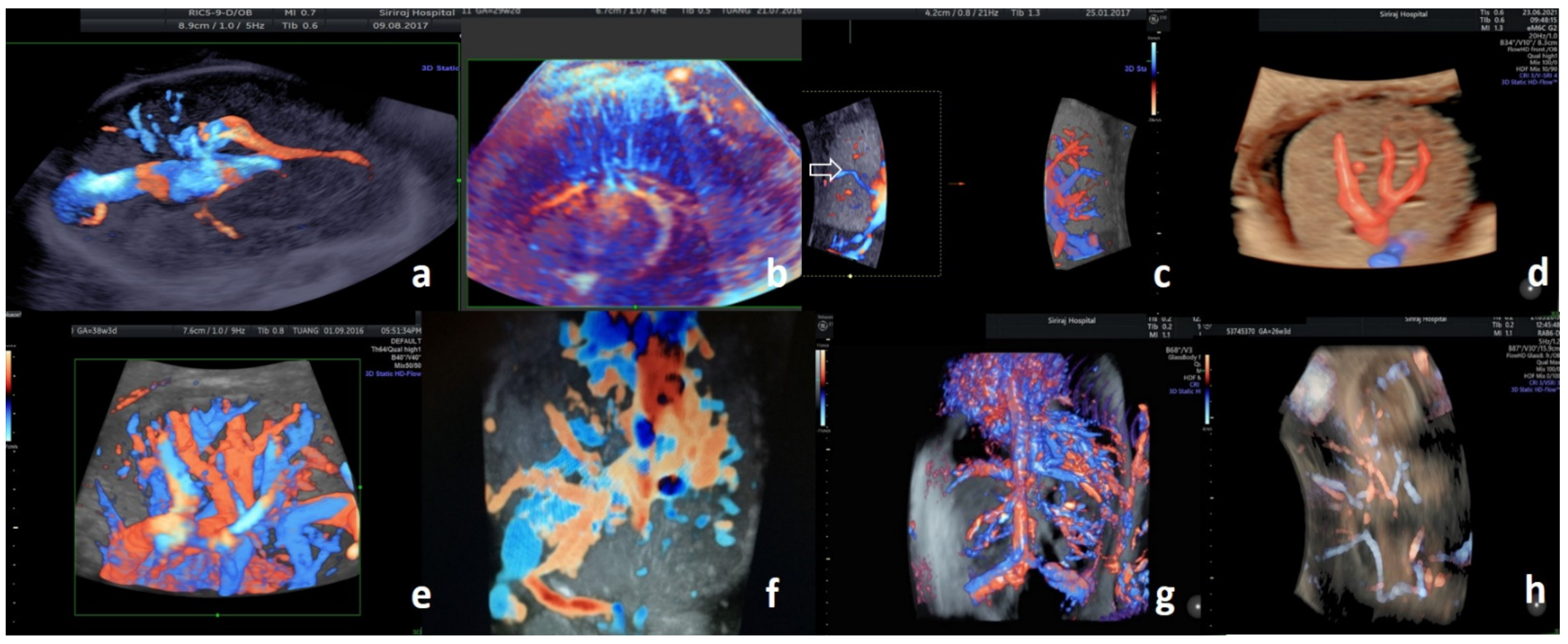 Diagnostics 11 01511 g001